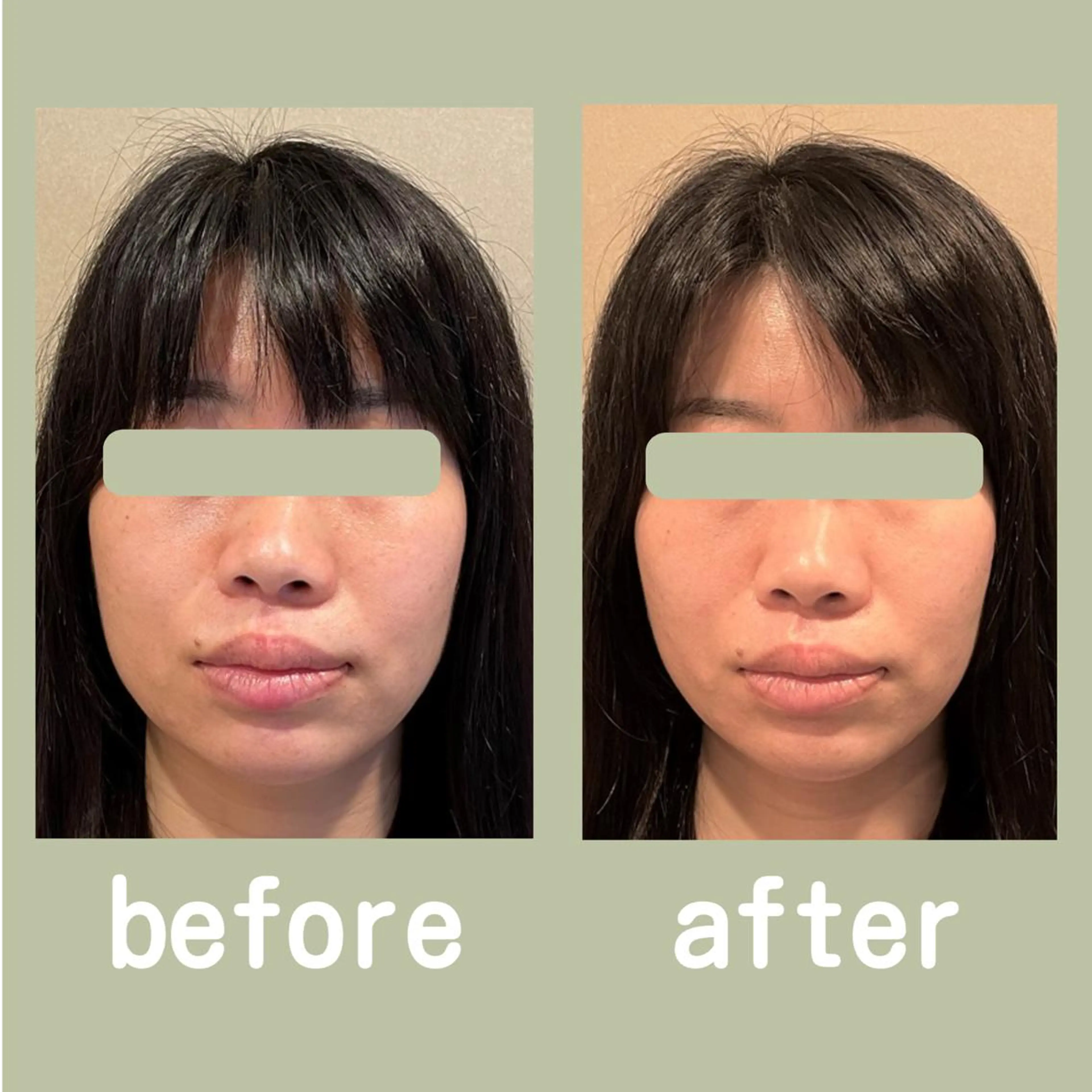 美容鍼灸サロン APLUSのエステ・リラクイメージ