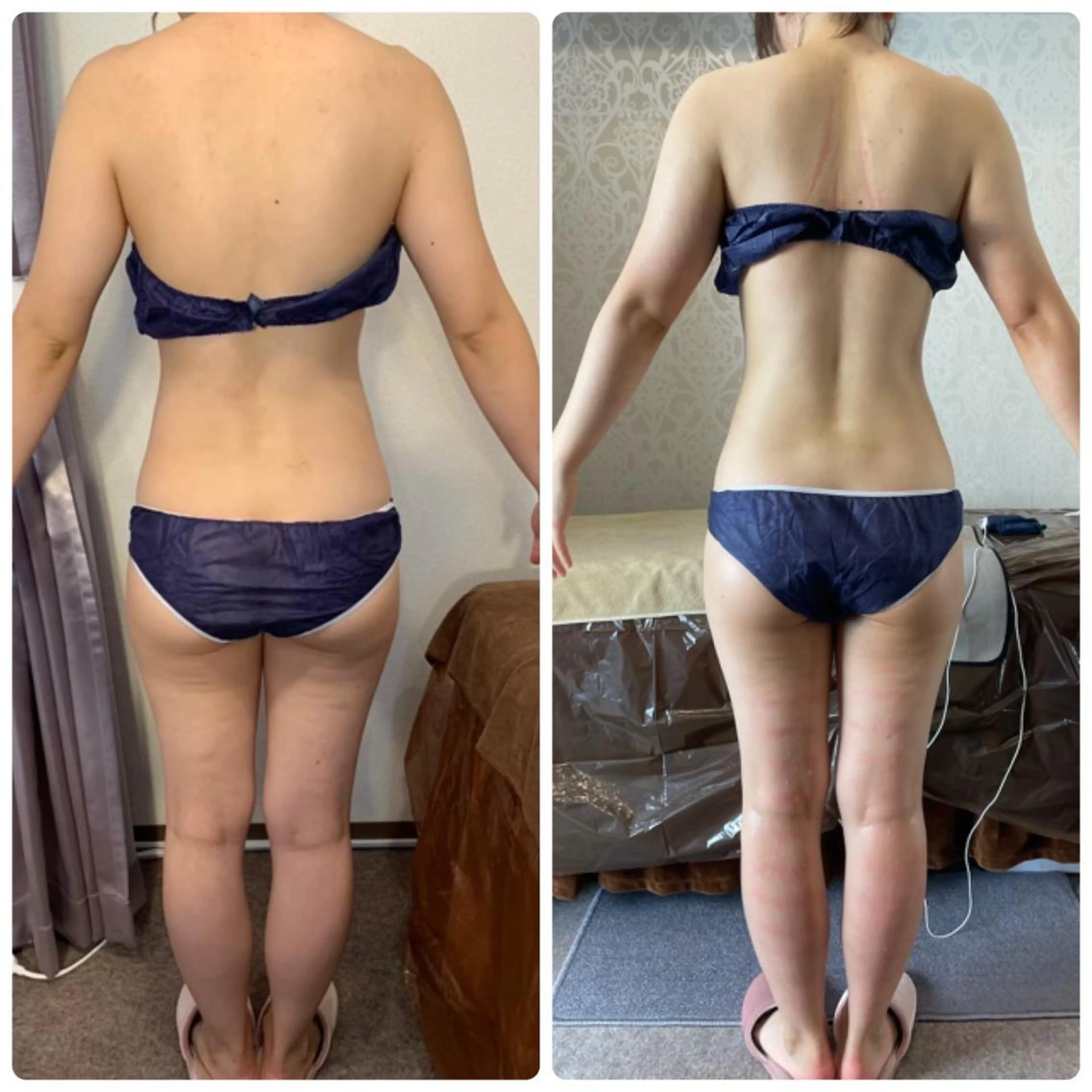 FLEUR 2号店のエステ・リラクイメージ