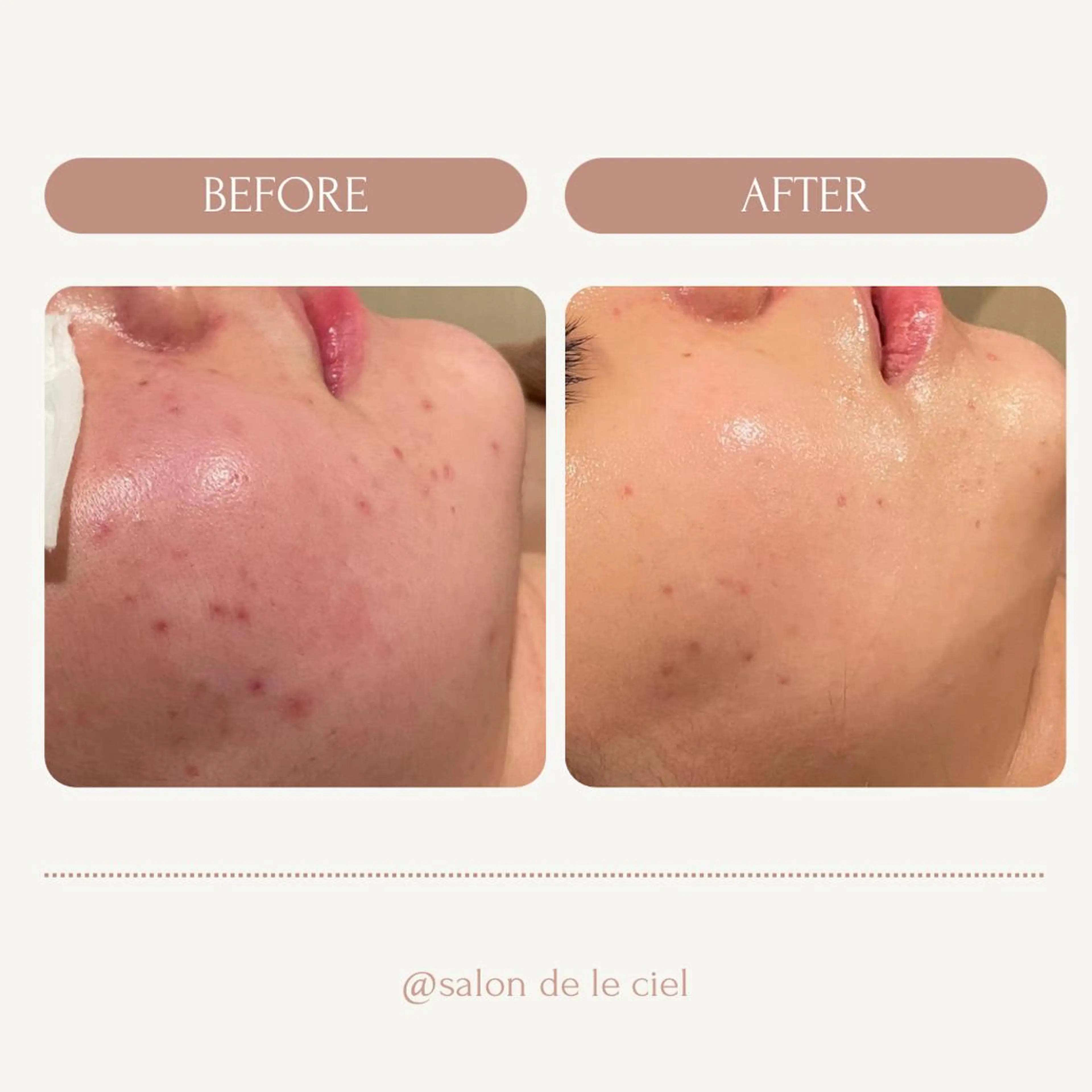 サロンドゥ ルシエルのエステ・リラクイメージ