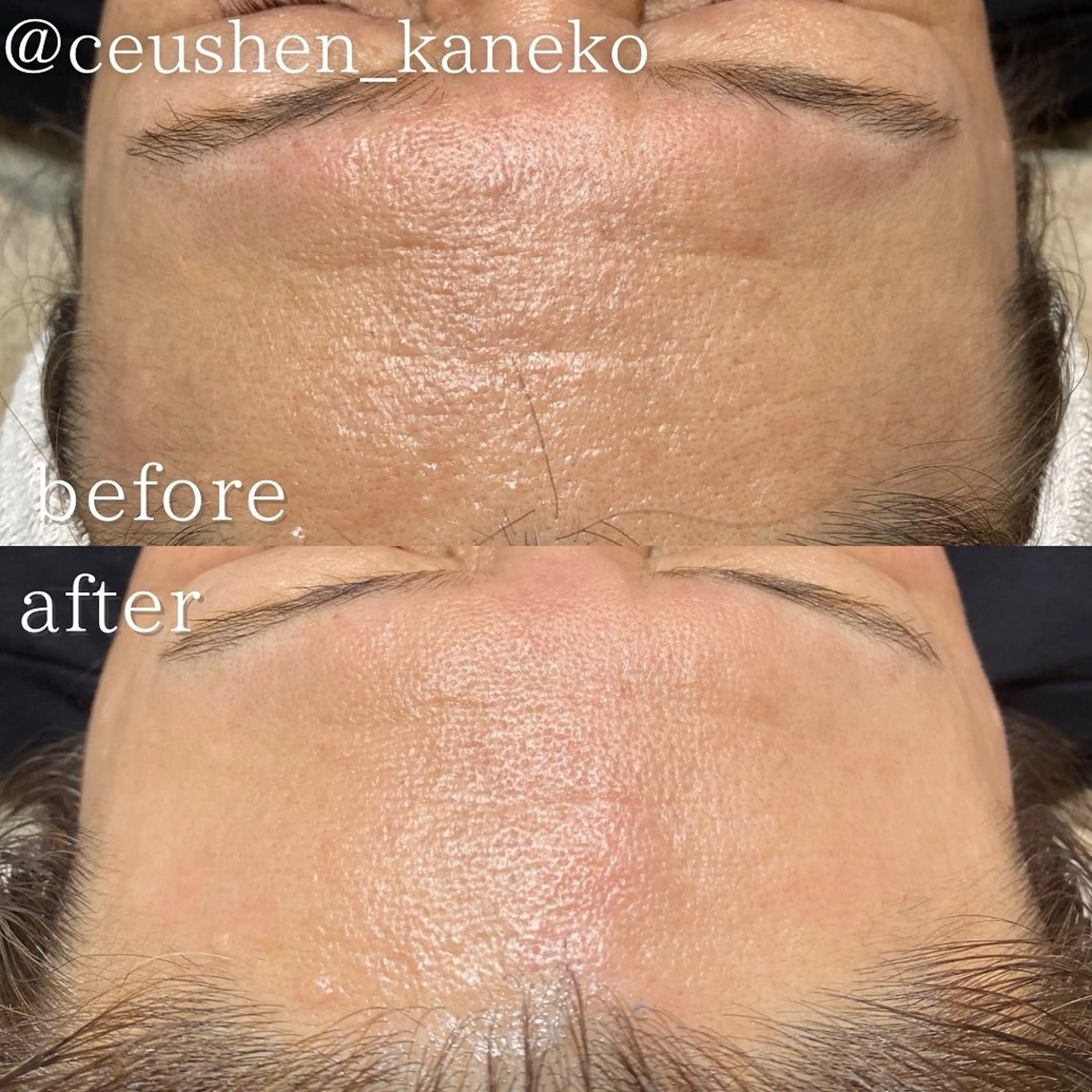 アイブロウ 眉毛ワックス脱毛 mone~total care salon~所属・mone (モーネ)のエステ・リラクイメージ