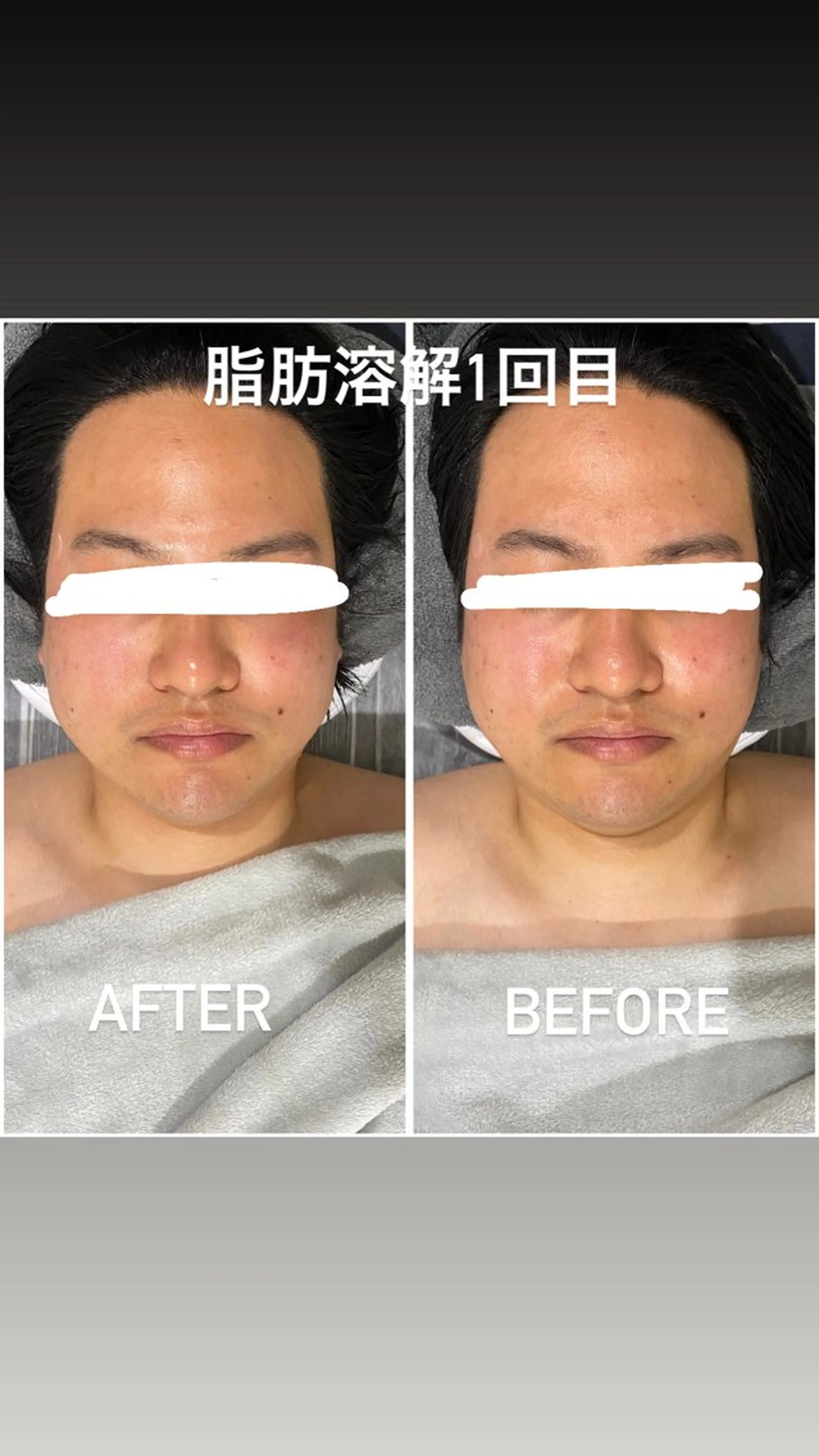 エステ アルカンジュ~archange~所属・痩身/毛穴洗浄/脱毛 アルカンジュのエステ・リラクイメージ