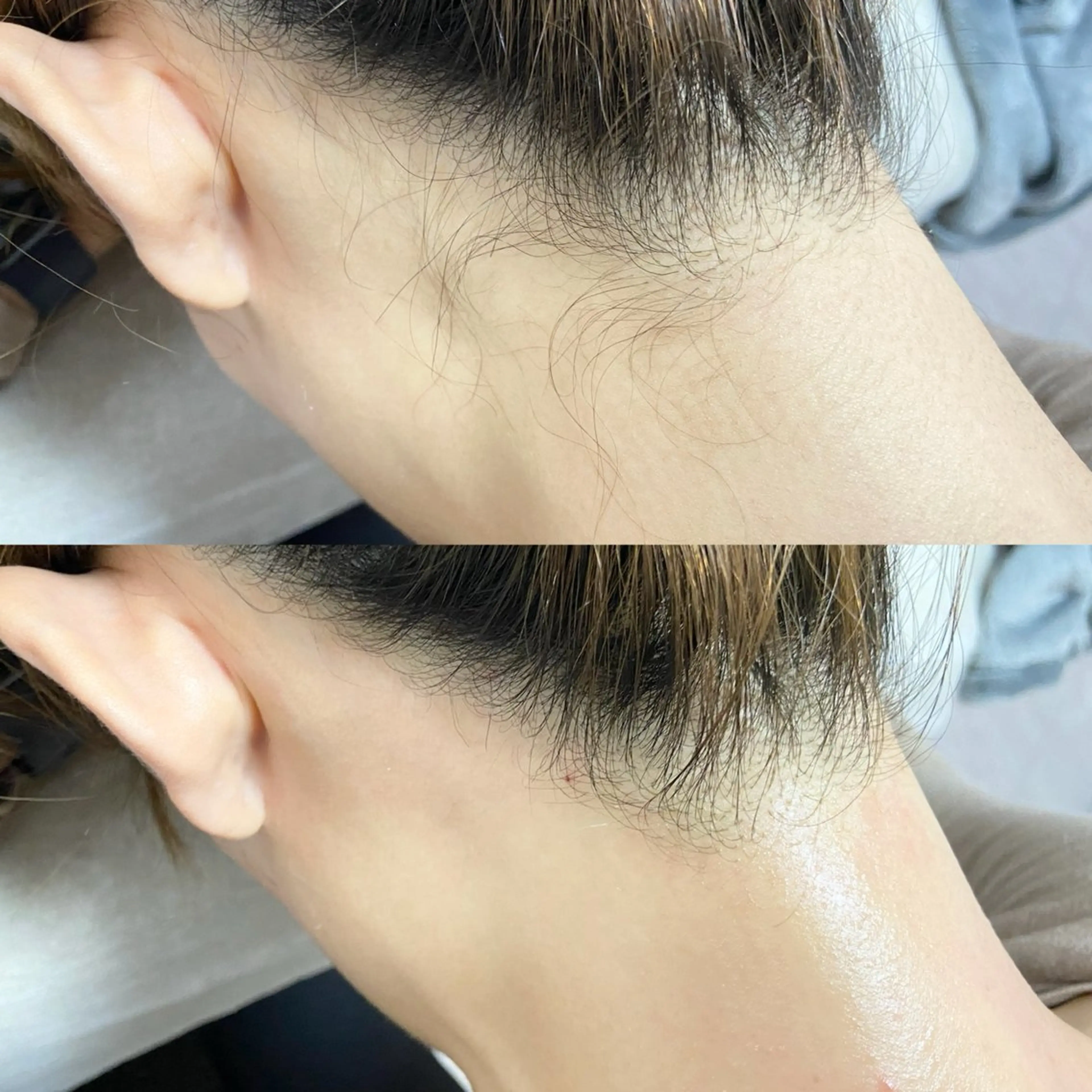 脱毛 &me ayakaのエステ・リラクイメージ