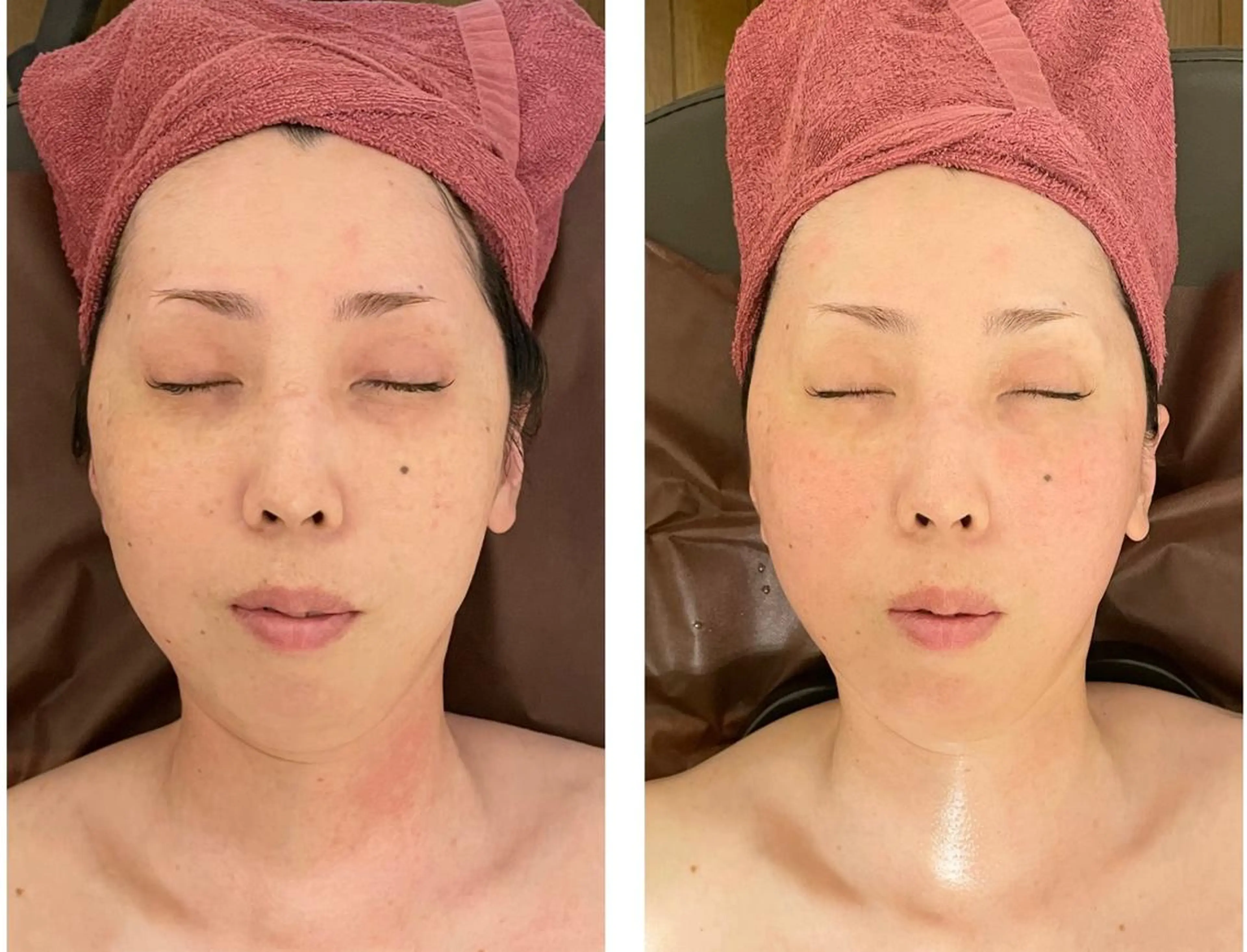 35歳からの エイジングケアサロンのエステ・リラクイメージ