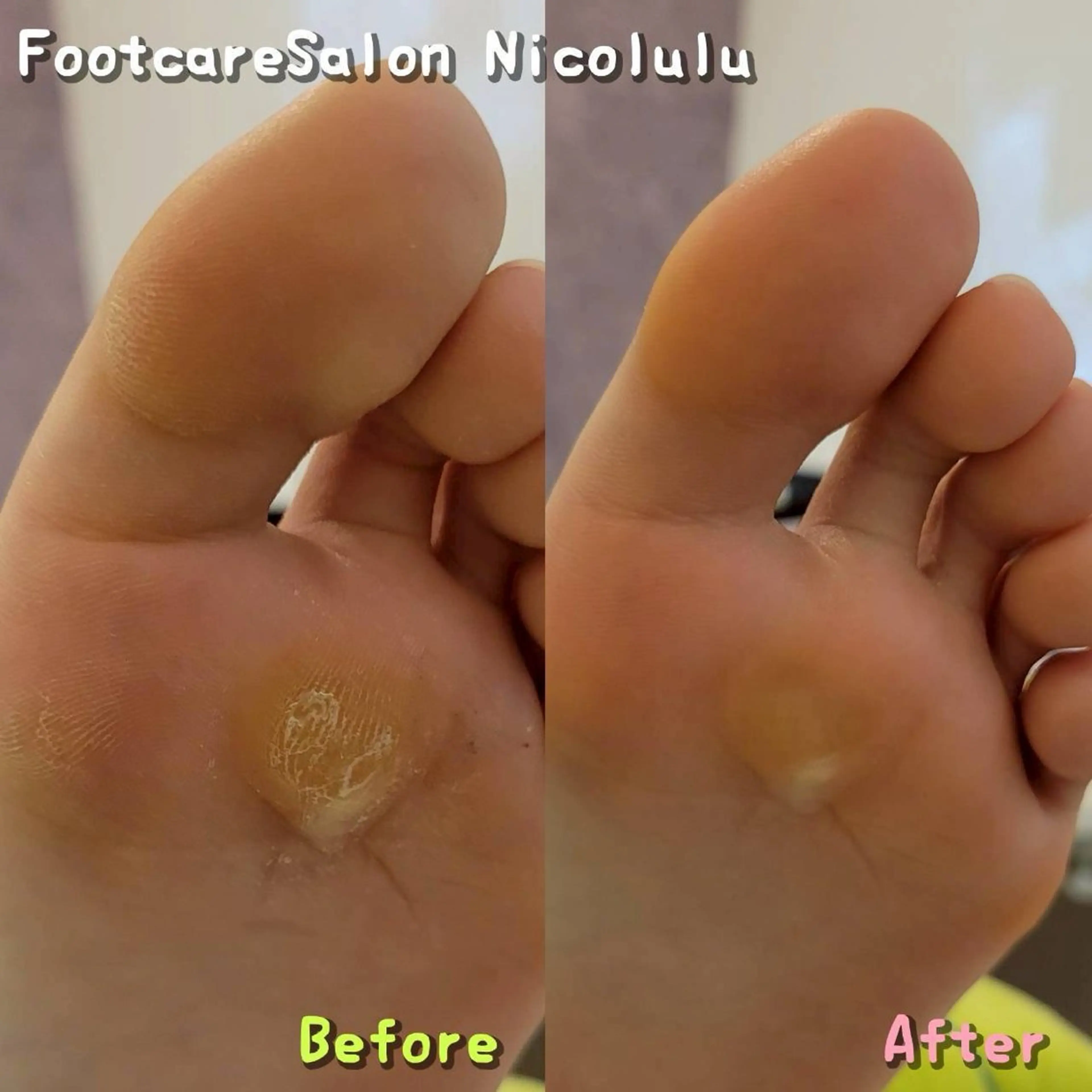 足トラブル専門 ニコルル金沢のエステ・リラクイメージ