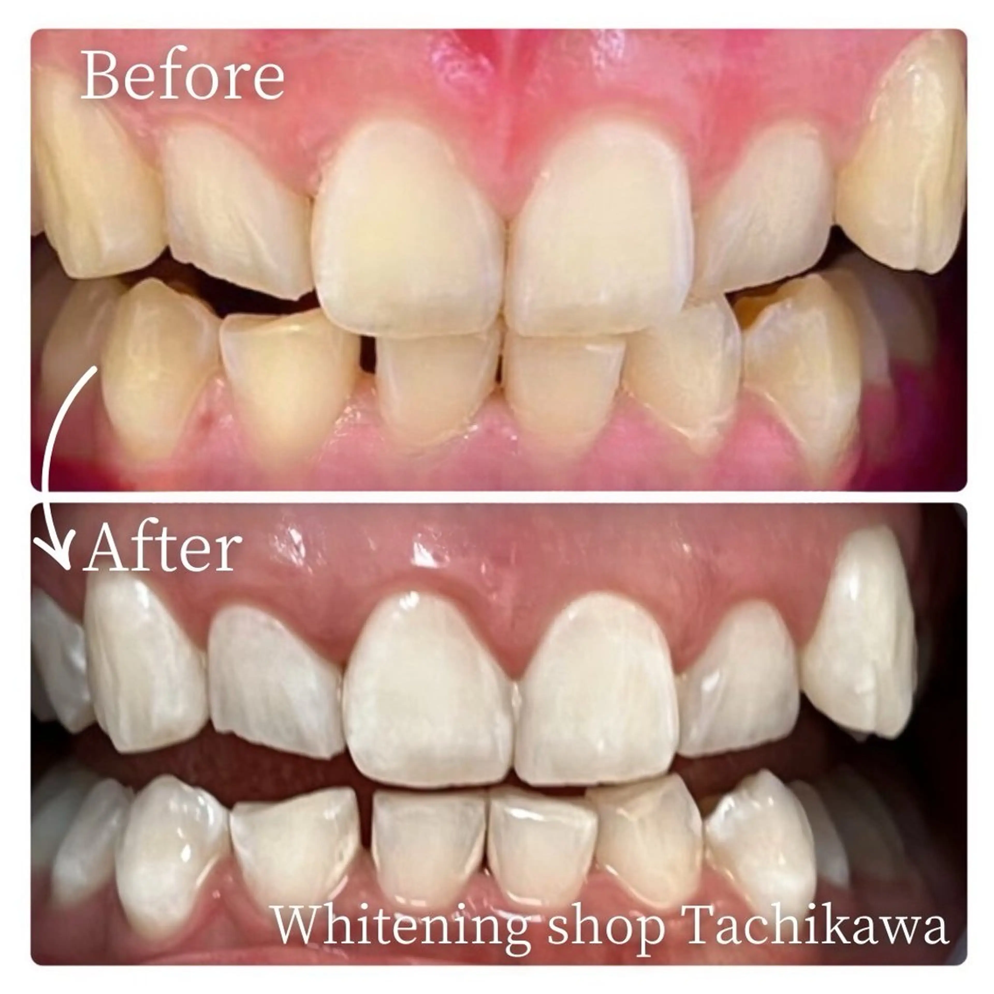 セルフ　ホワイト ニングショップ立川のその他イメージ