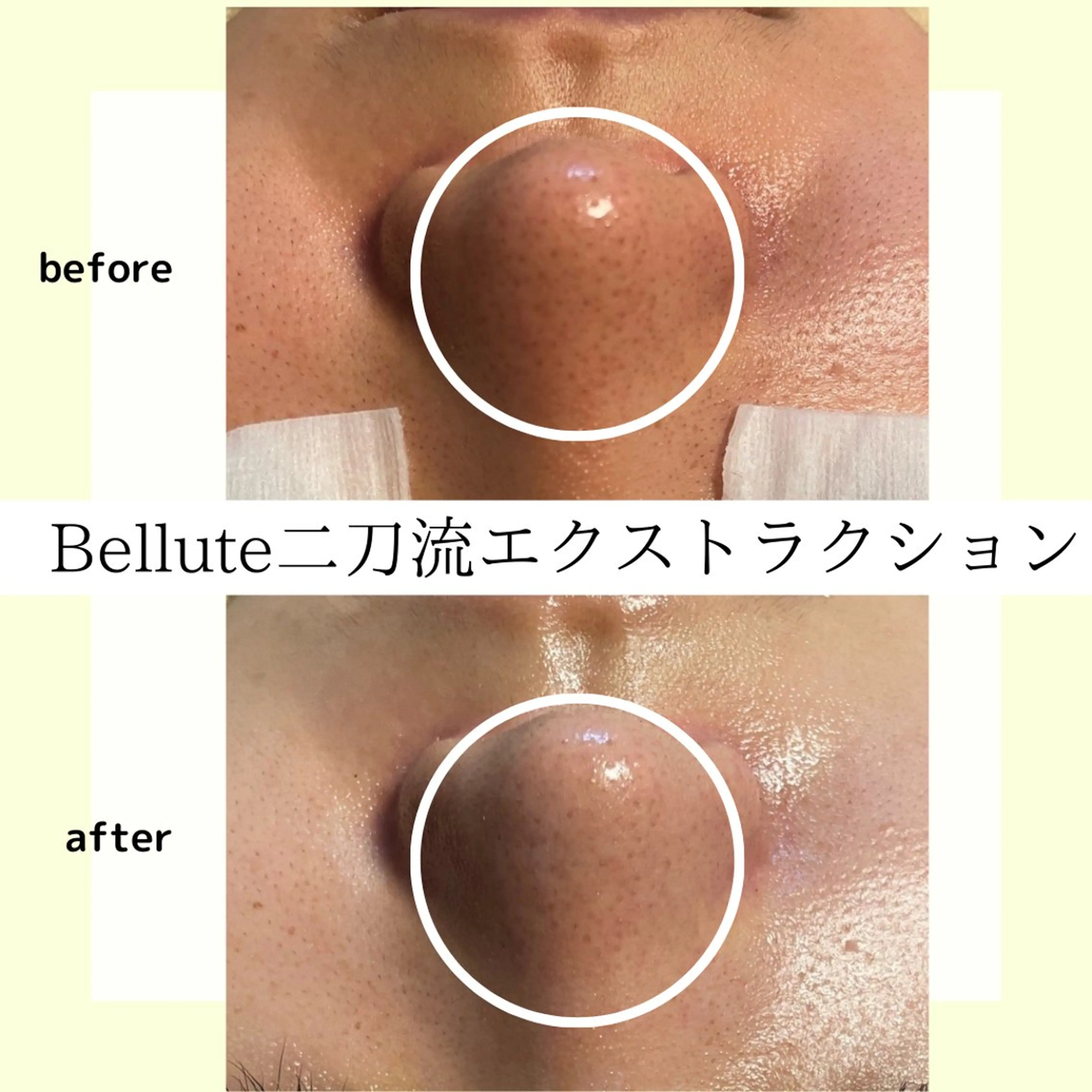 ピーリング専門店 Belluteのエステ・リラクイメージ