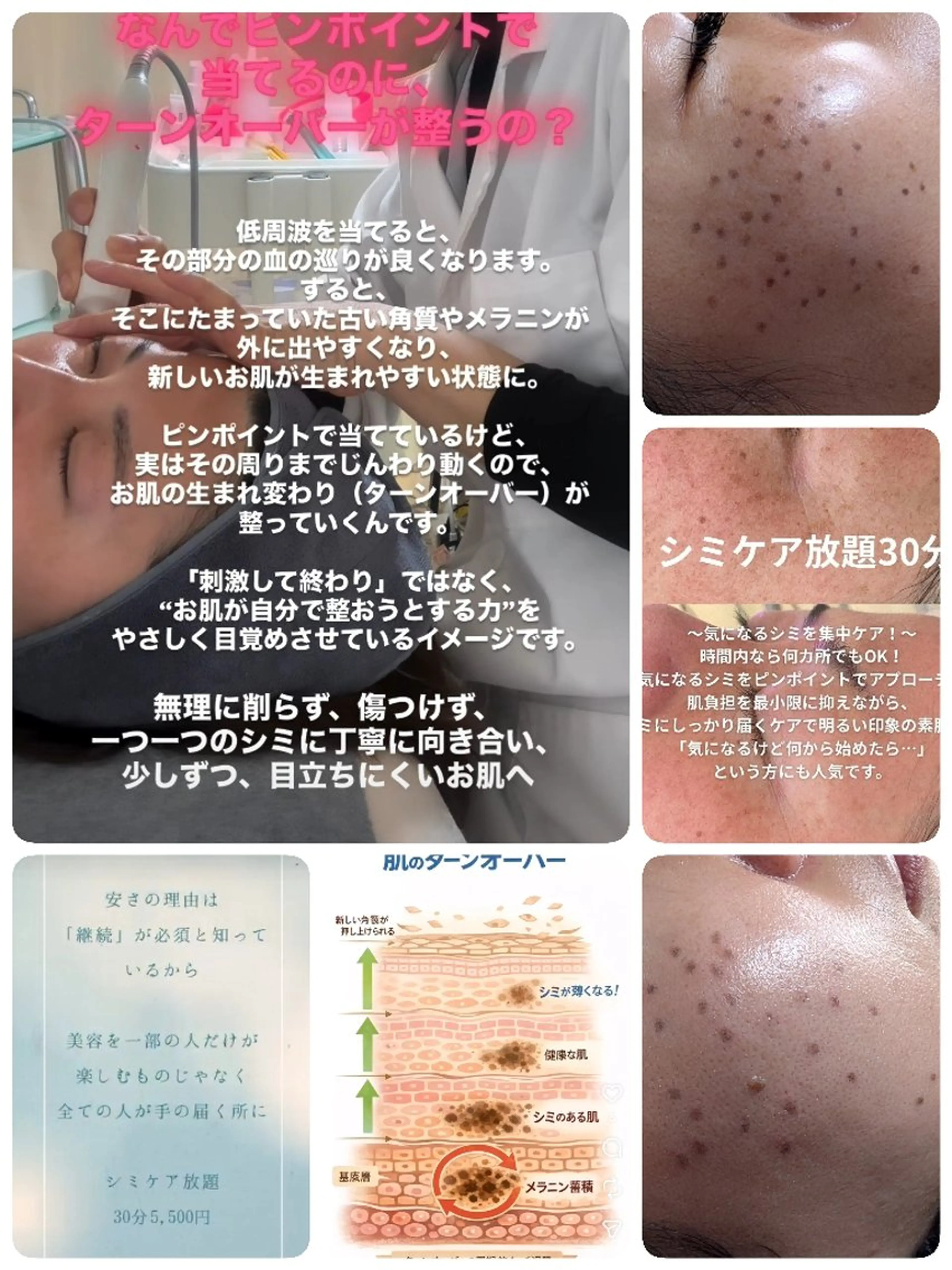 SPOT.com  シミケア専門店のエステ・リラクイメージ