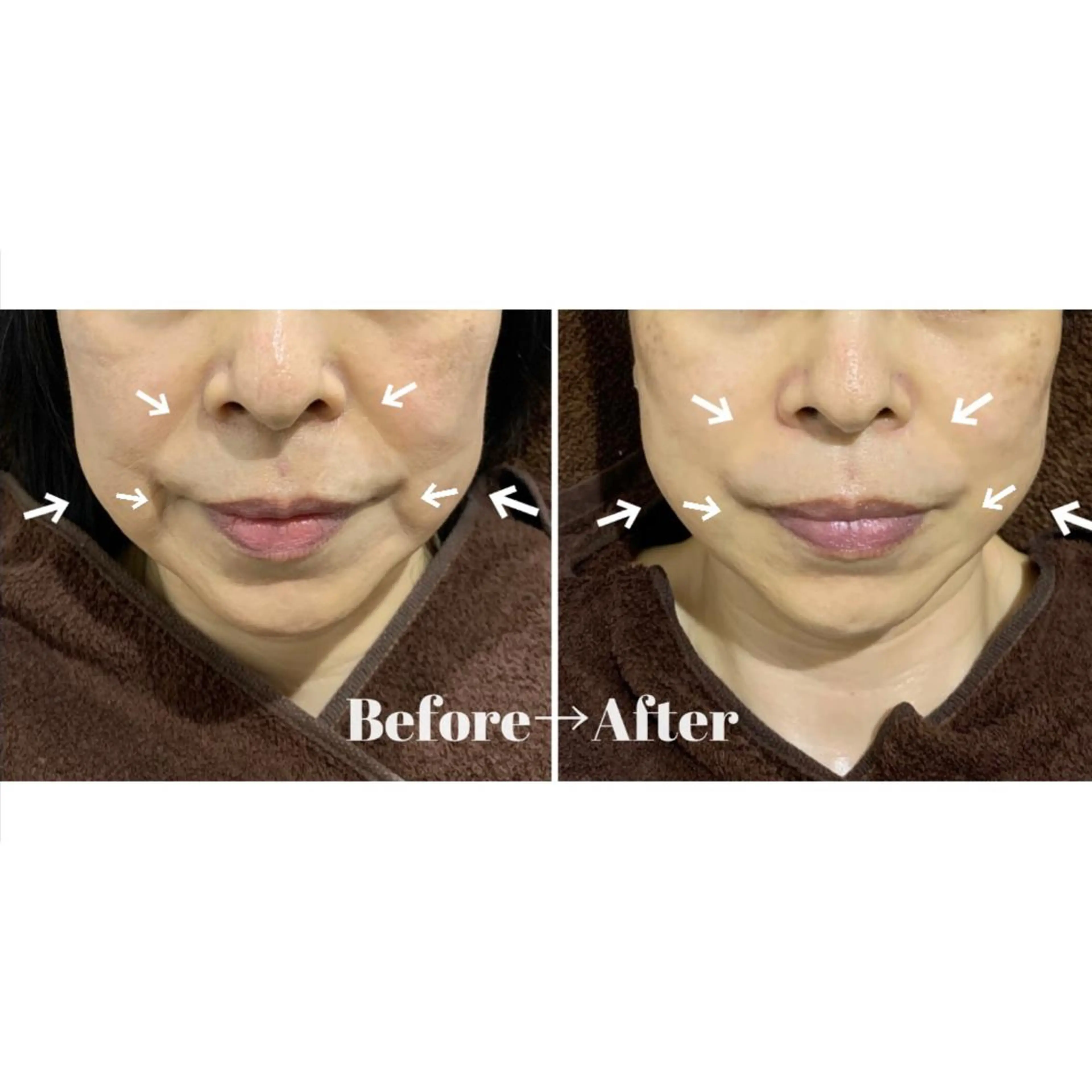 エステ よもぎ蒸しエステサロン★yun所属・よもぎ蒸しサロン ゆんのエステ・リラクイメージ