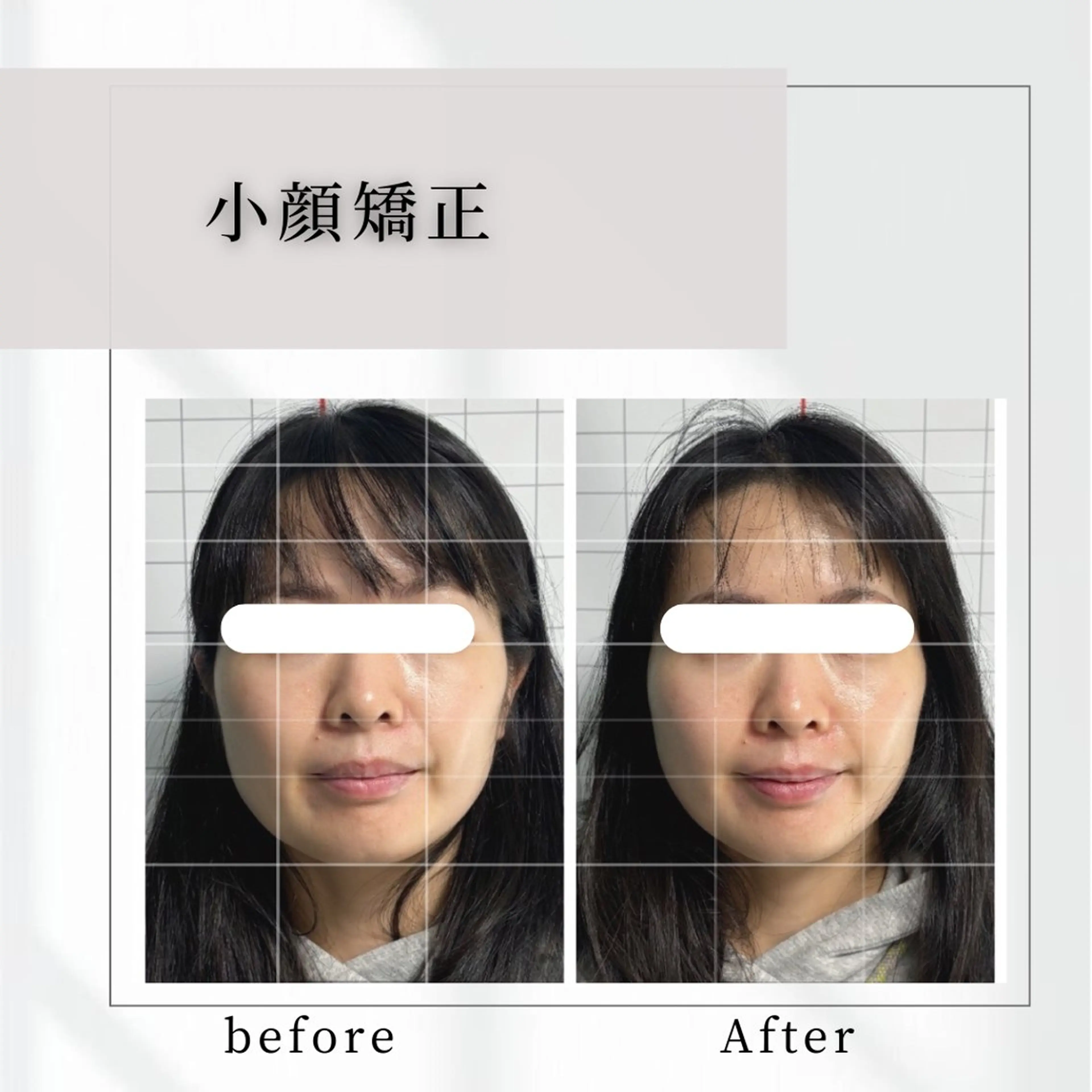 エステ リラク 小顔矯正専門店 【RED】池田のエステ・リラクイメージ