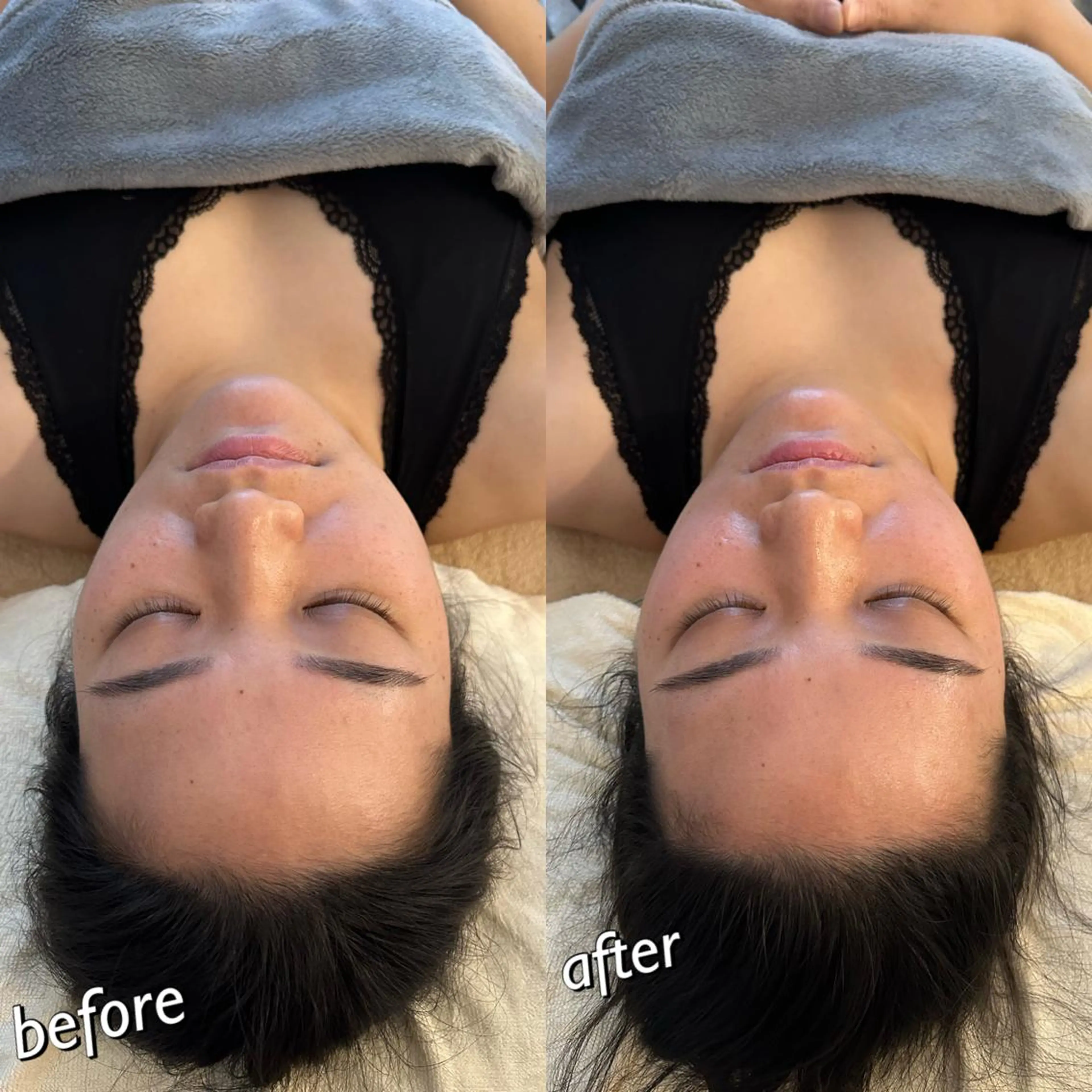 うなじ脱毛/美肌脱毛 LABELのエステ・リラクイメージ