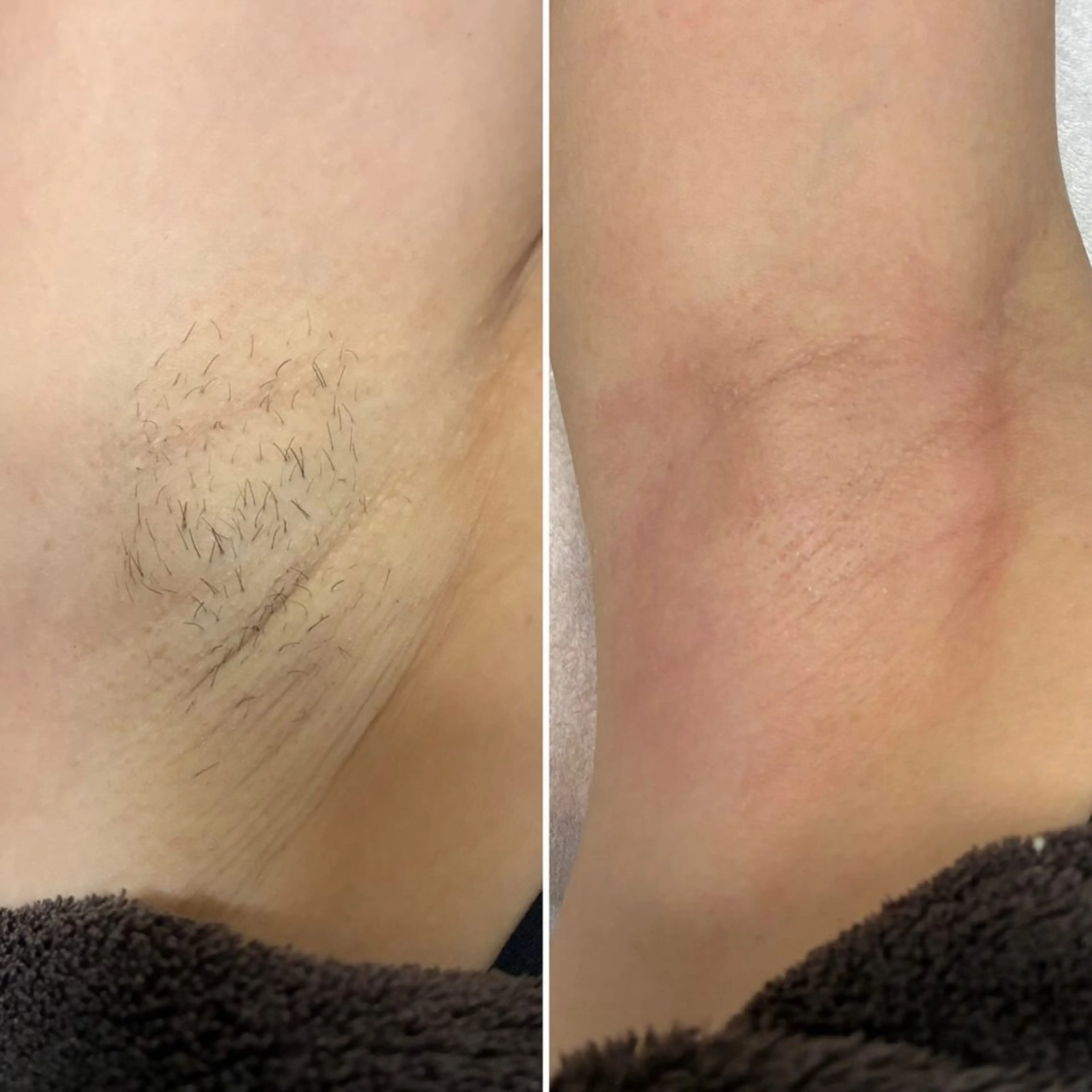 脱毛 padma シュガーリングのエステ・リラクイメージ