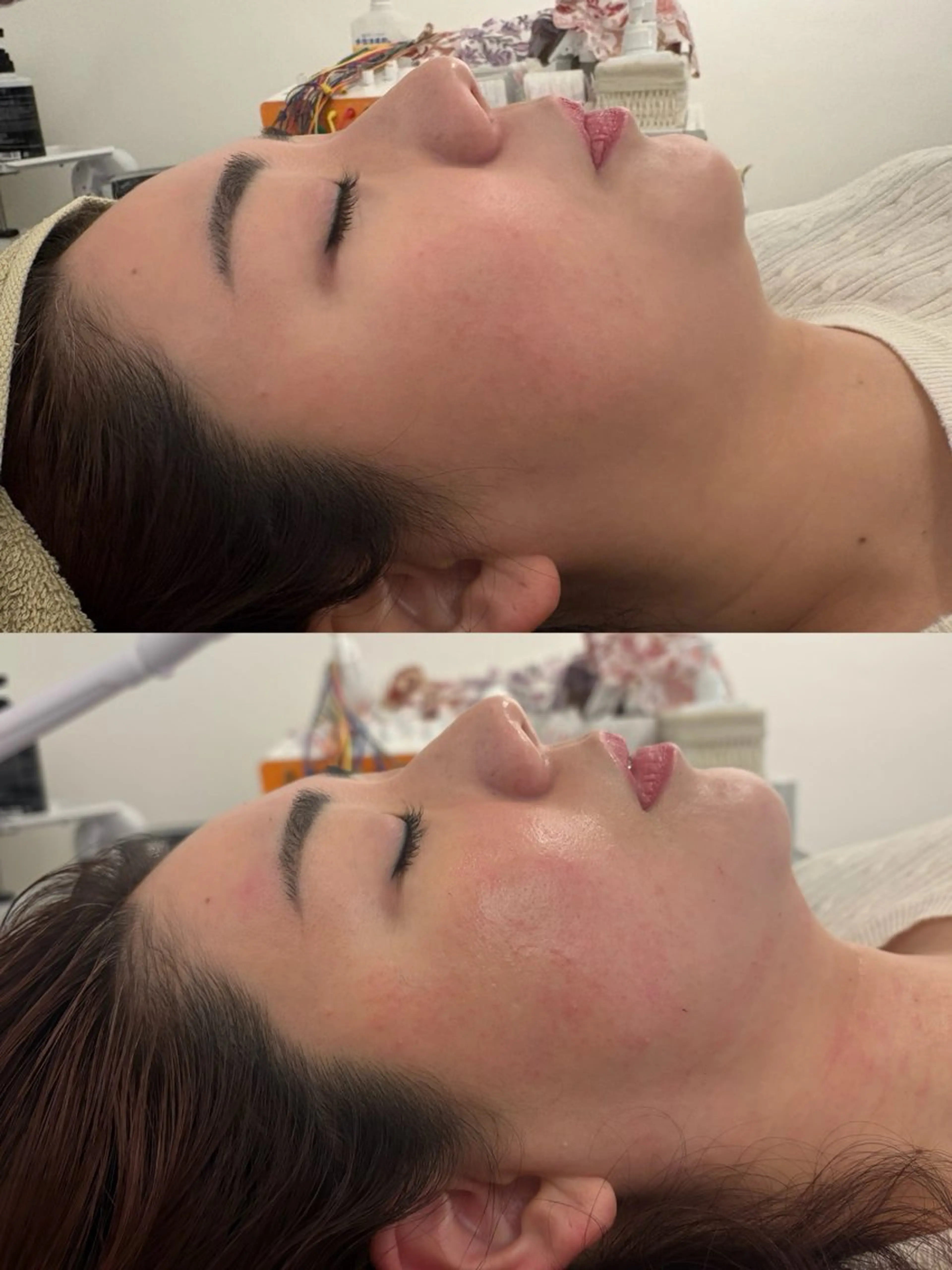 美容鍼灸サロン mahoroba院長のエステ・リラクイメージ