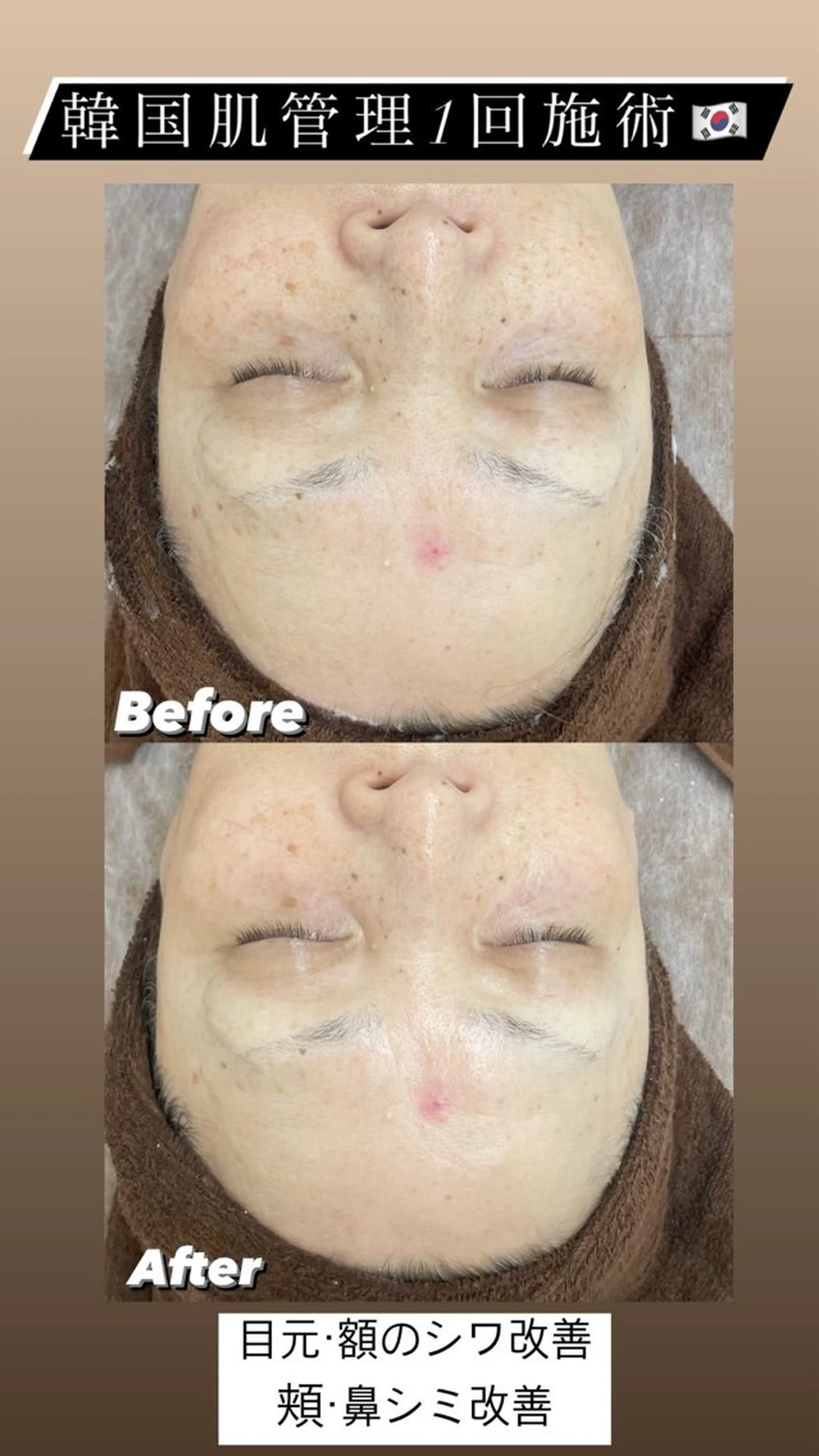 エステ レイエステティック スタッフのエステ・リラクイメージ