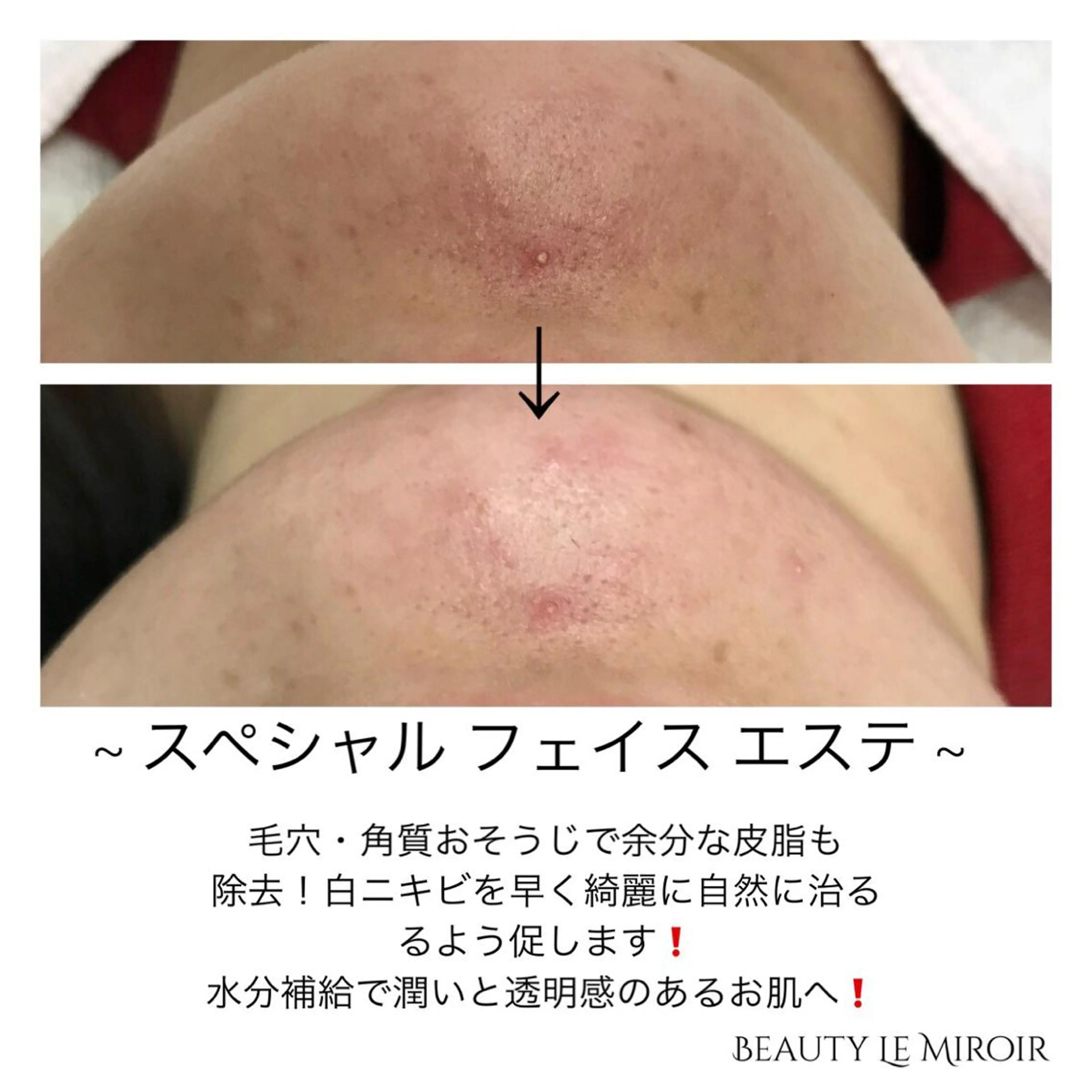 ビューティー ミロワールのエステ・リラクイメージ