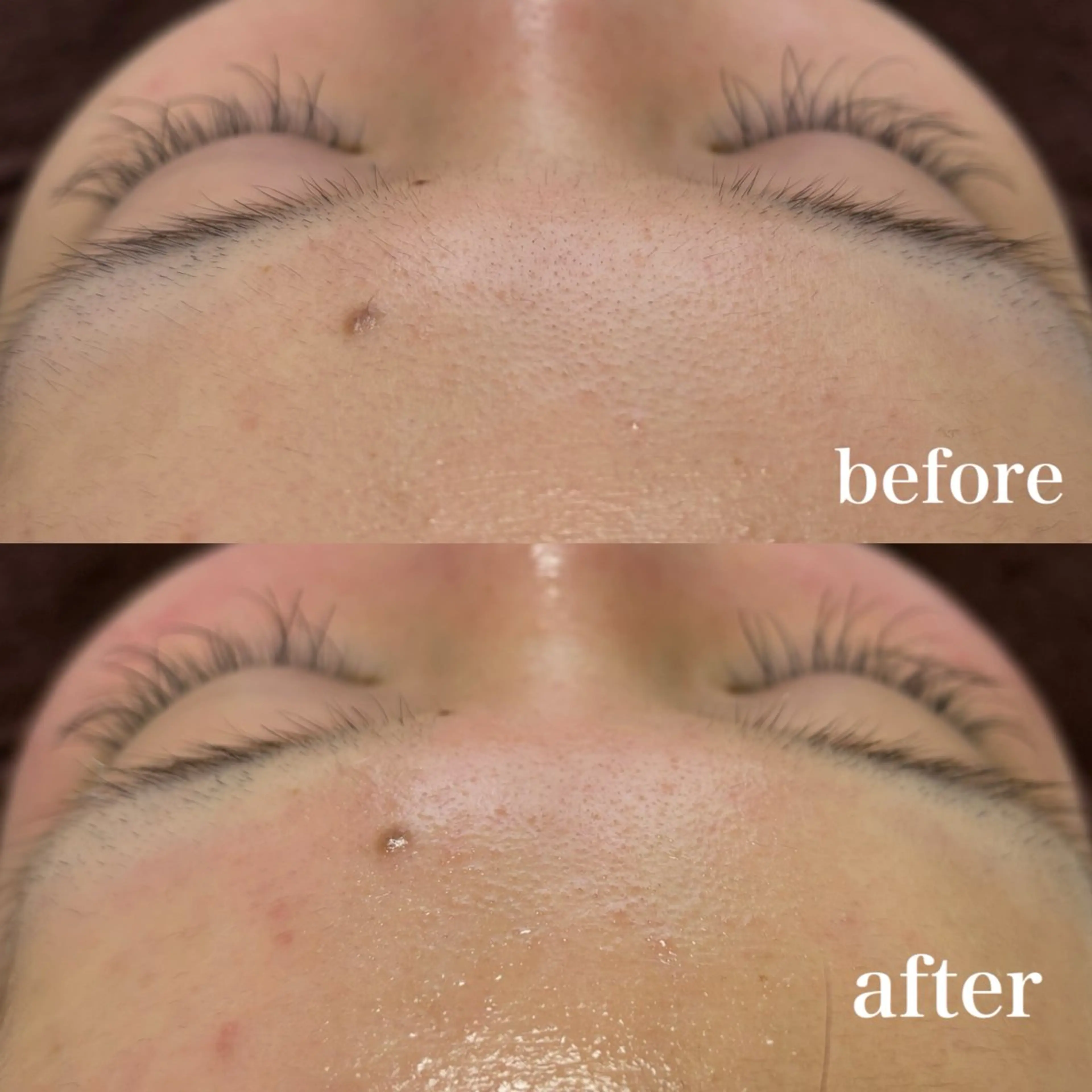 脱毛 美養HAREHADA 🫧/ Ibukiの眉毛・アイブロウイメージ