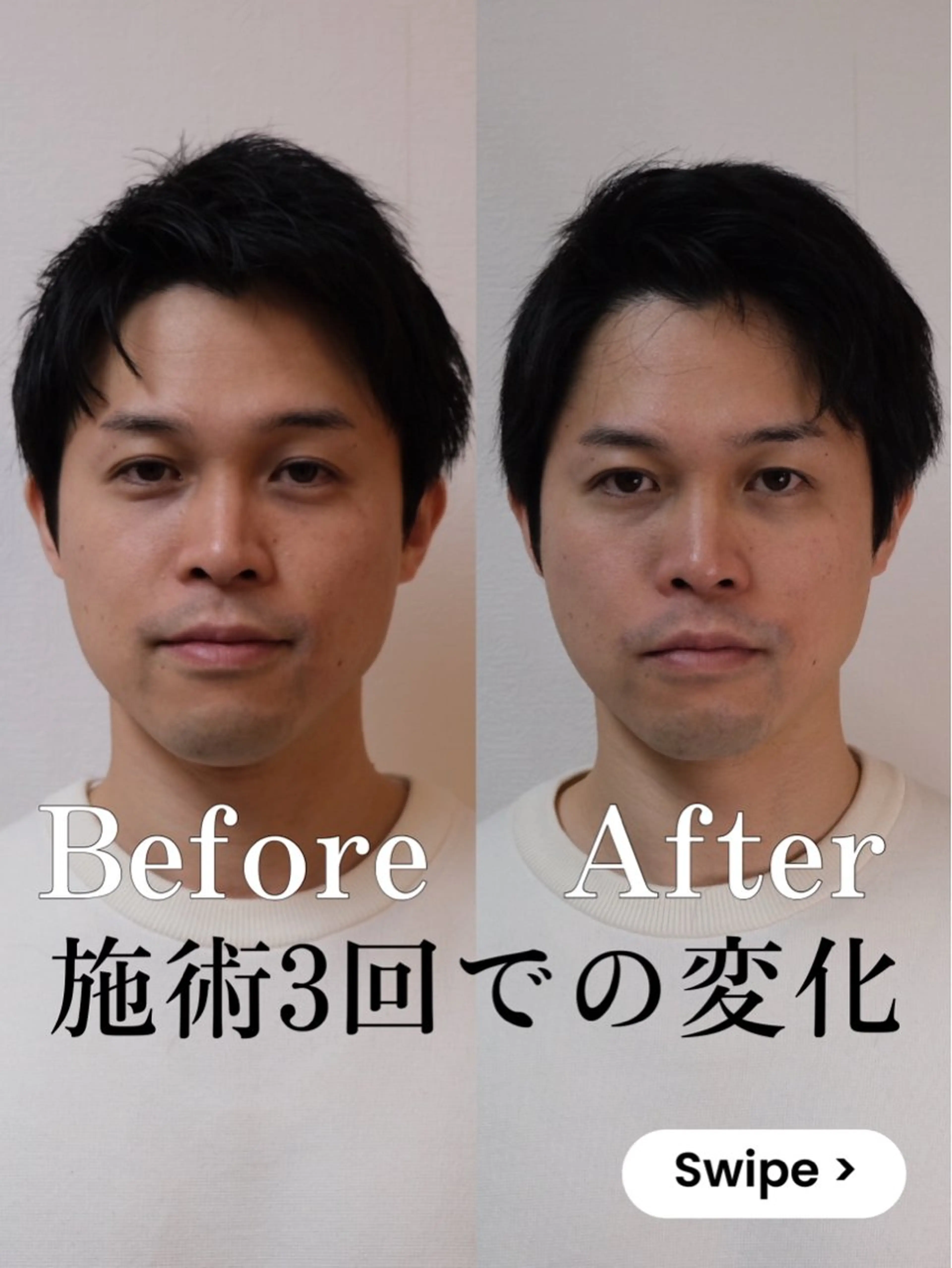 顔の整体 Nefert【ネフェルト】所属・こやま りょうのエステ・リラクイメージ