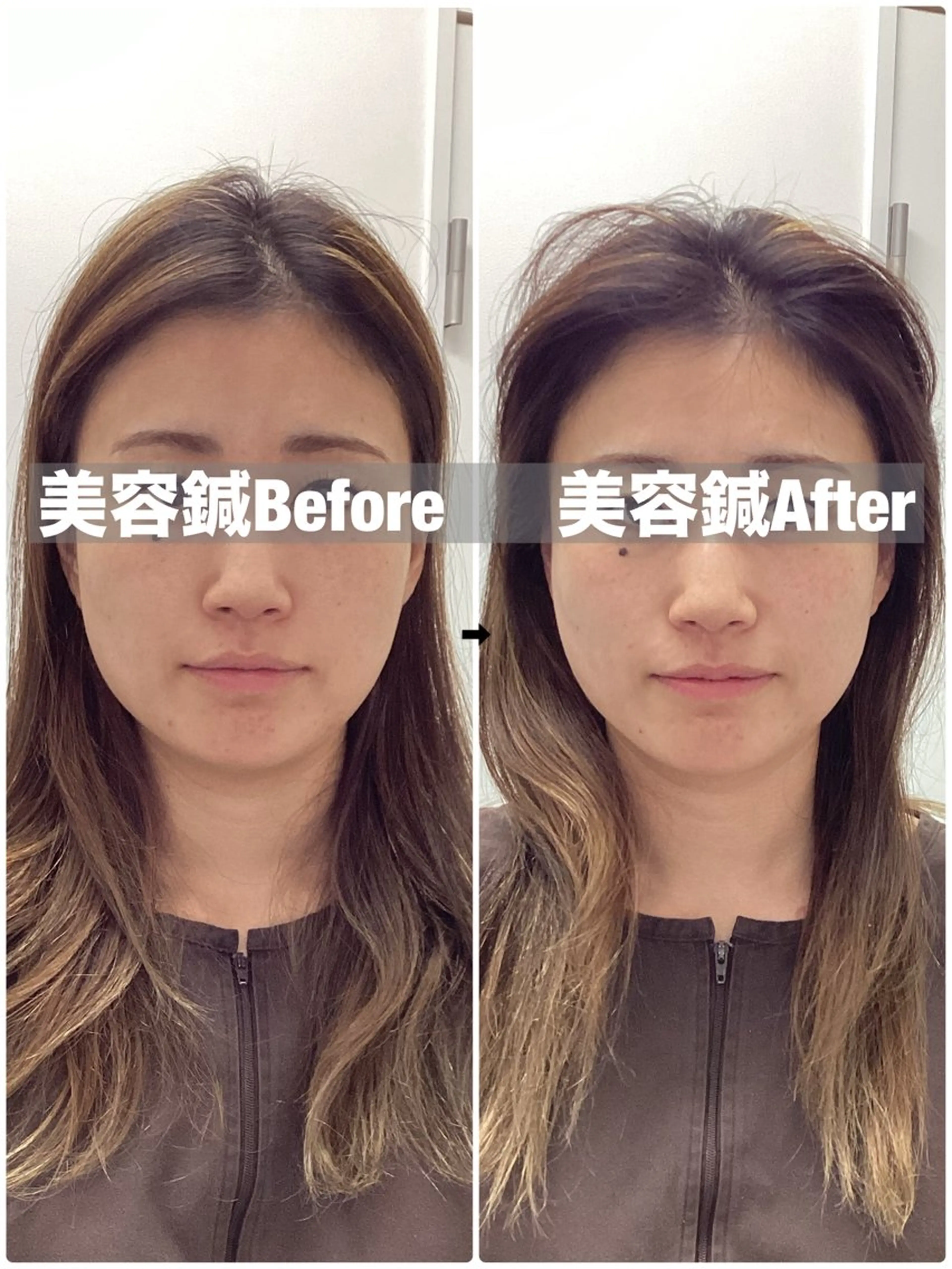 エステ リラク メディカルサロンドオフ所属・ハリサロンドオフ 美容鍼灸×小顔整体のエステ・リラクイメージ