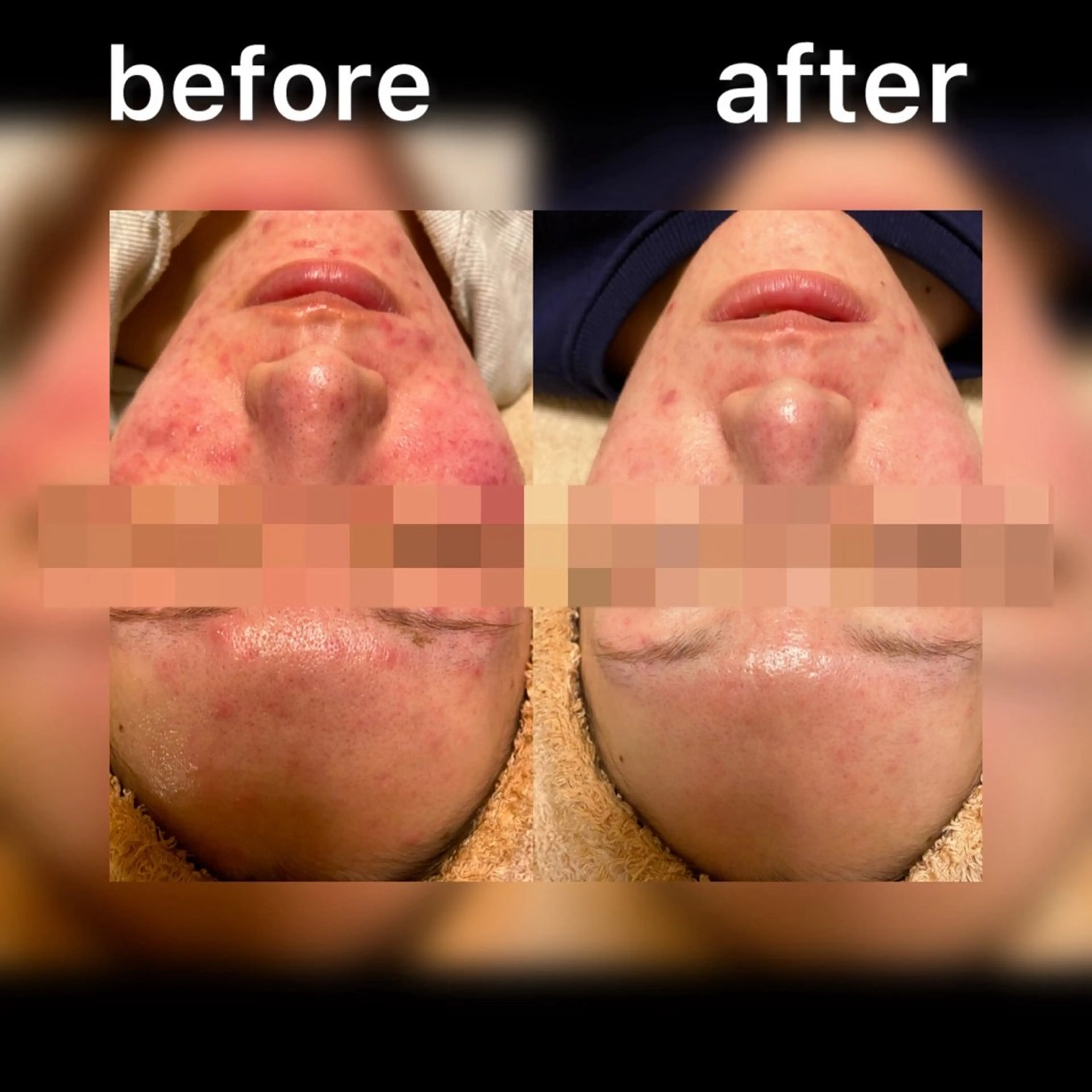 ピーリング・脱毛専門 Fofo泉区店のその他イメージ