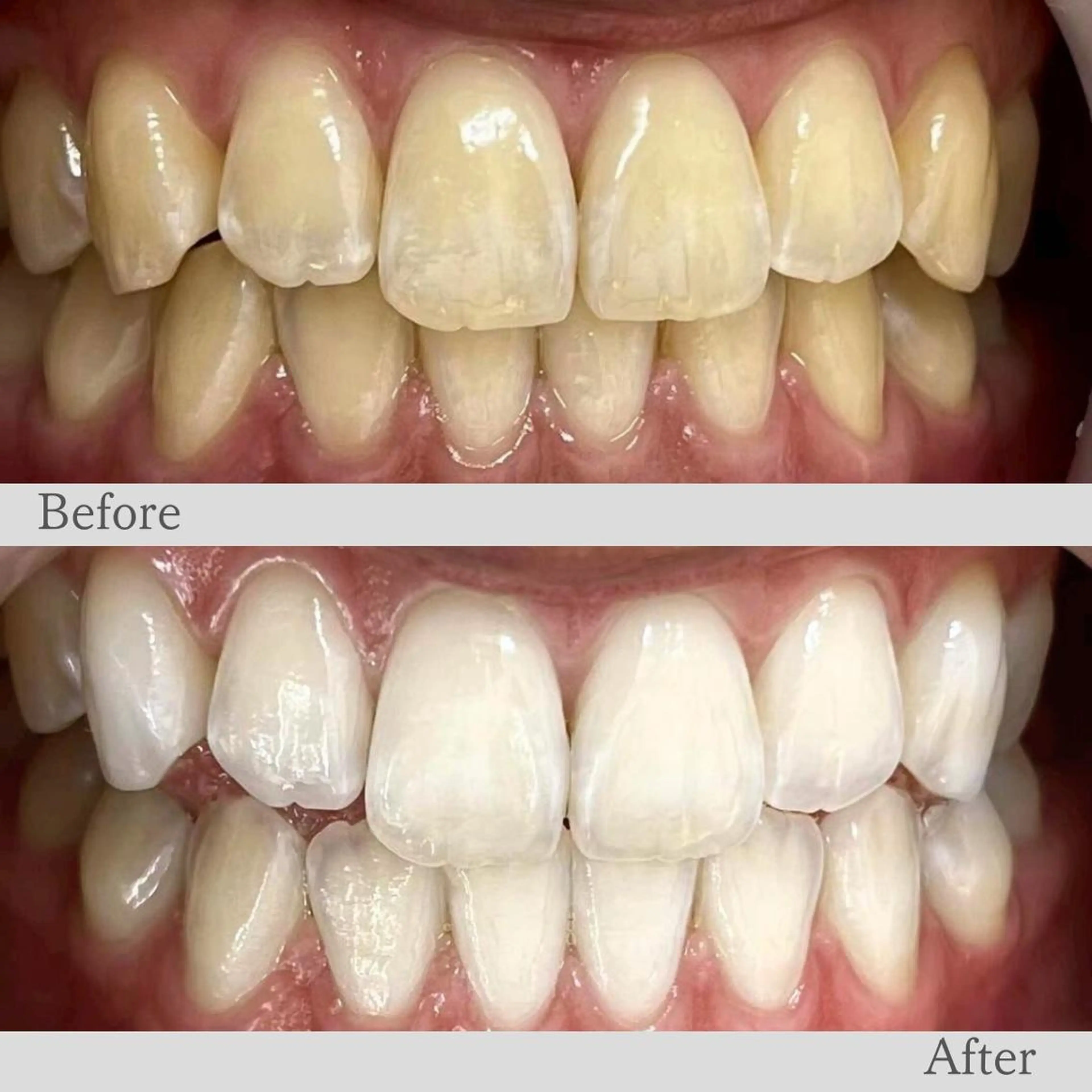 エステ リラク LBS吉祥寺 公式のエステ・リラクイメージ