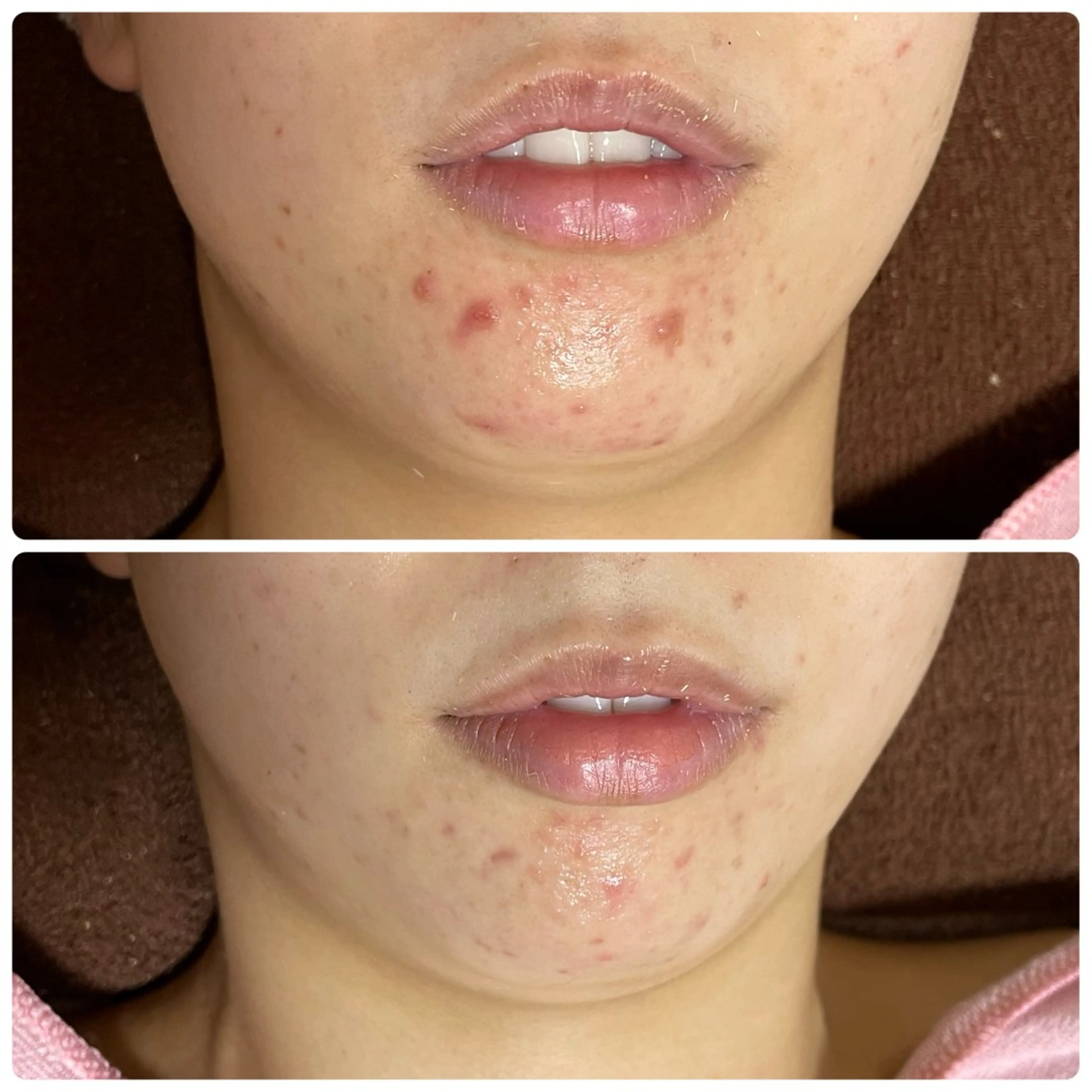 M.riche エムリシェのエステ・リラクイメージ