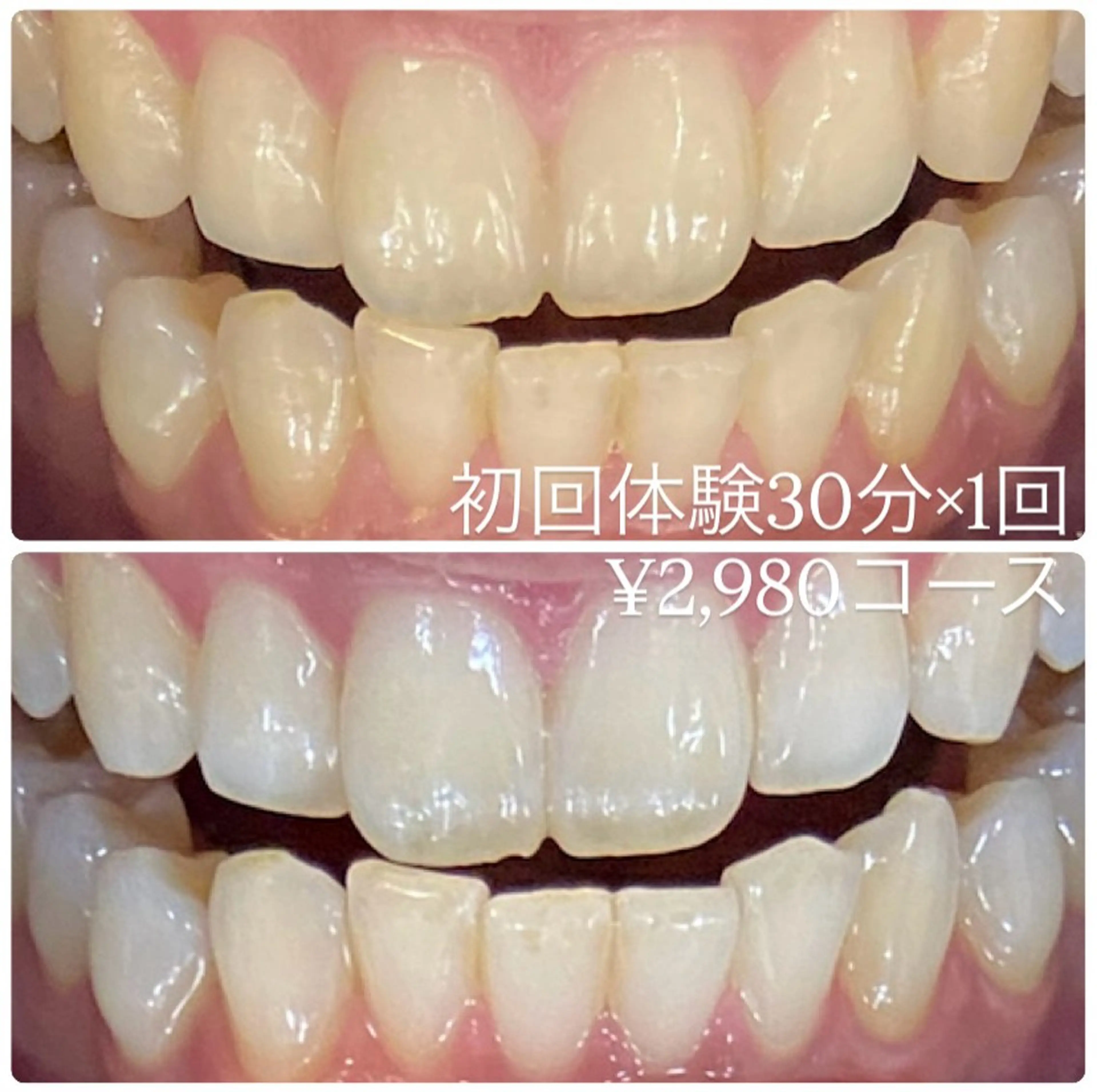 ホワイトニングルーム 横浜店のその他イメージ