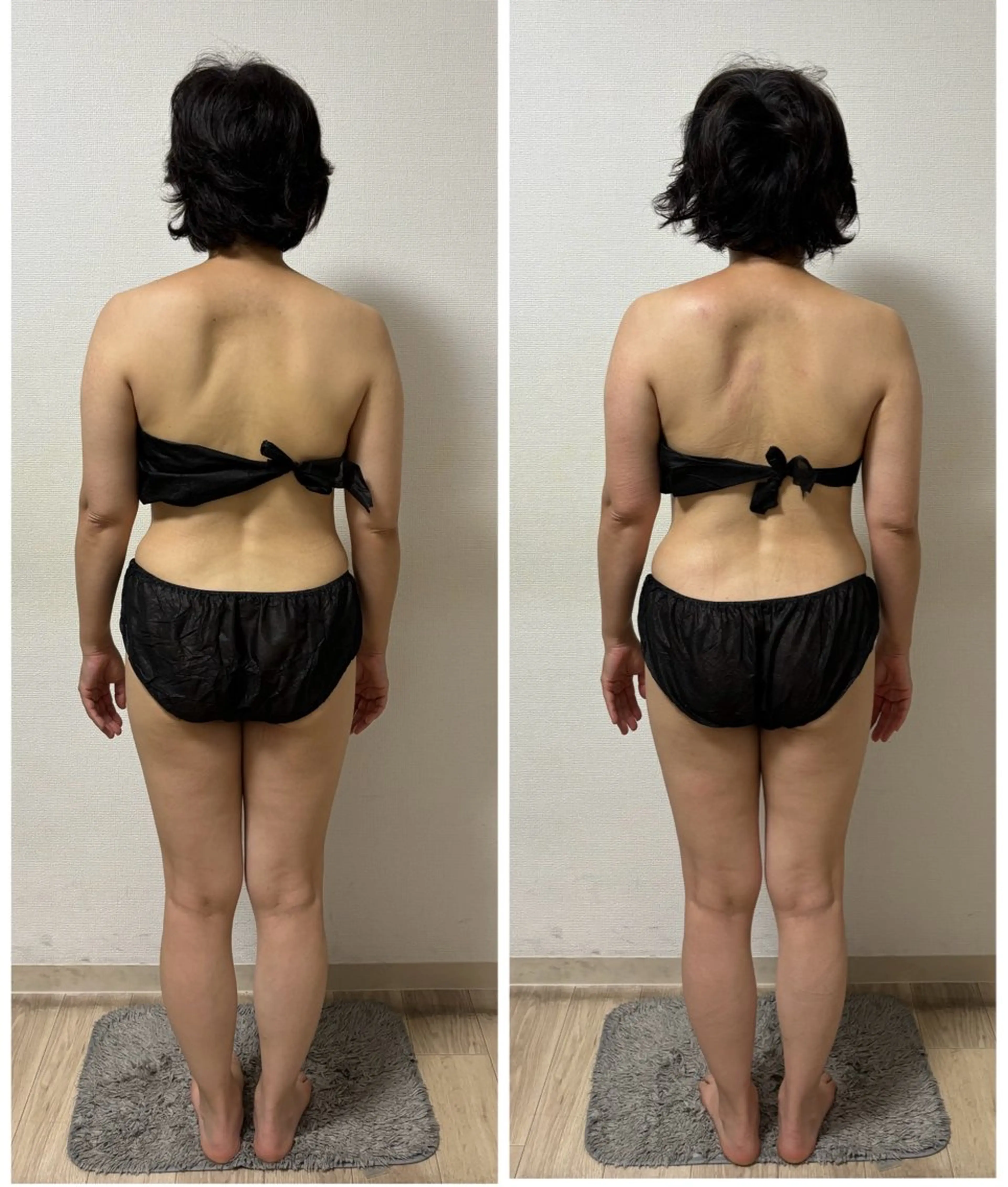 🌺ロミロミ痩身背面🌺45分の写真