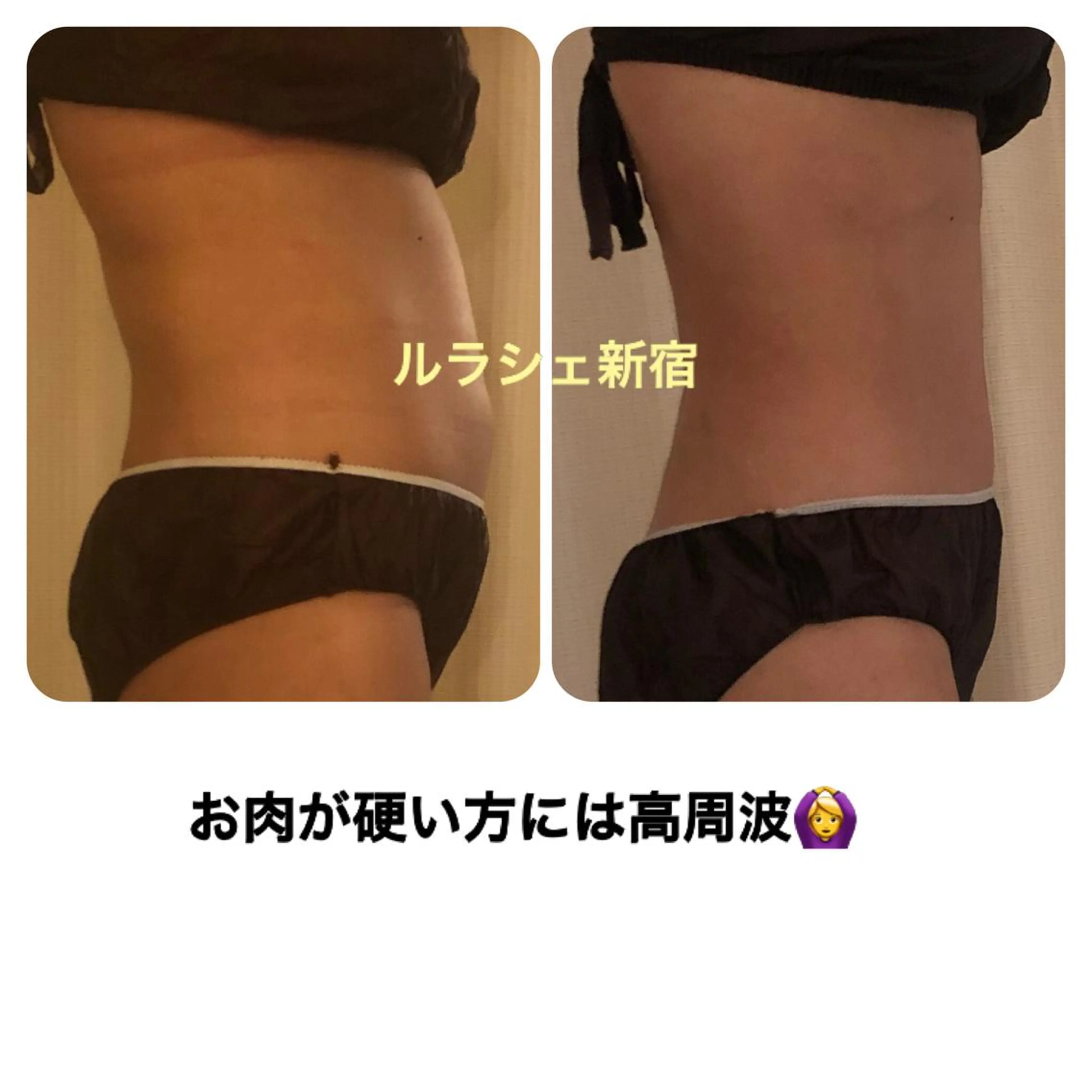 【痩身】インドエステ ＆筋膜リリースのエステ・リラクイメージ