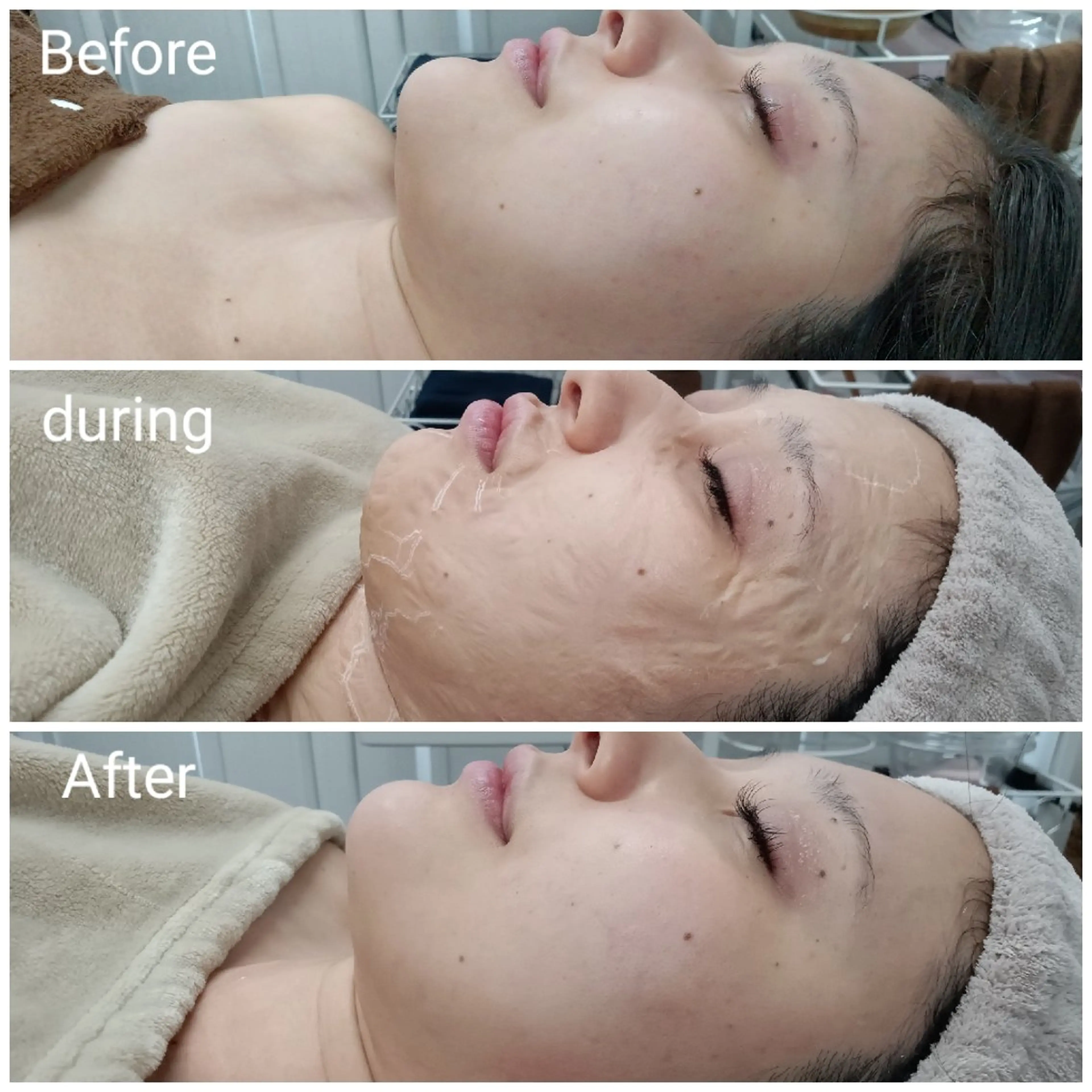 肌質改善Beauty salon Renのエステ・リラクイメージ