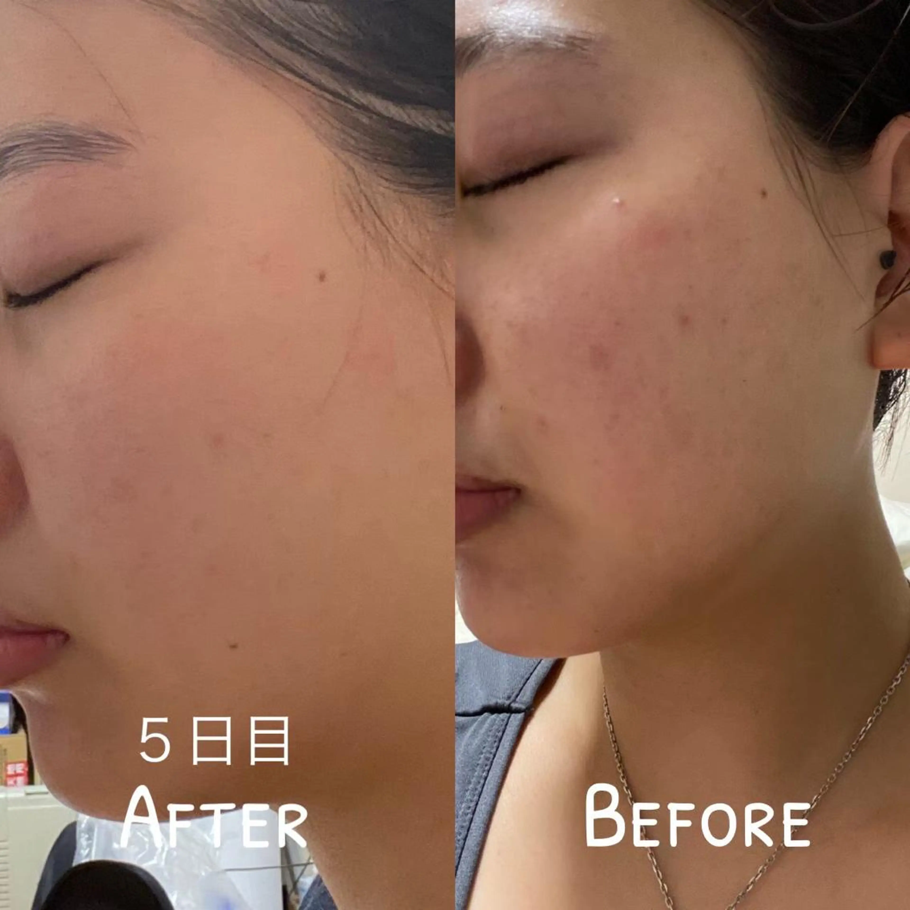 tominaga ryokoのヘアスタイル