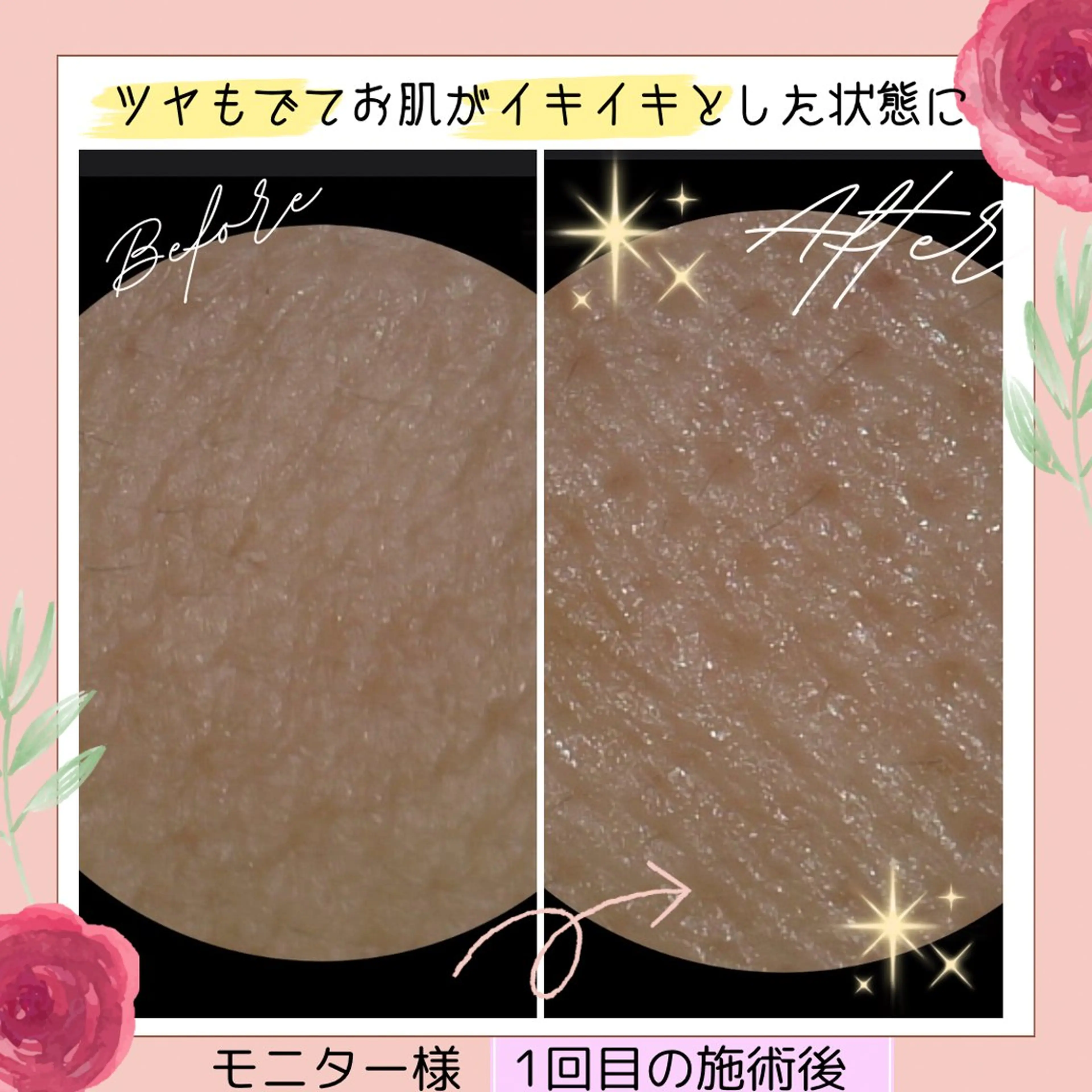 ペルラジョーネ💄 emiのエステ・リラクイメージ