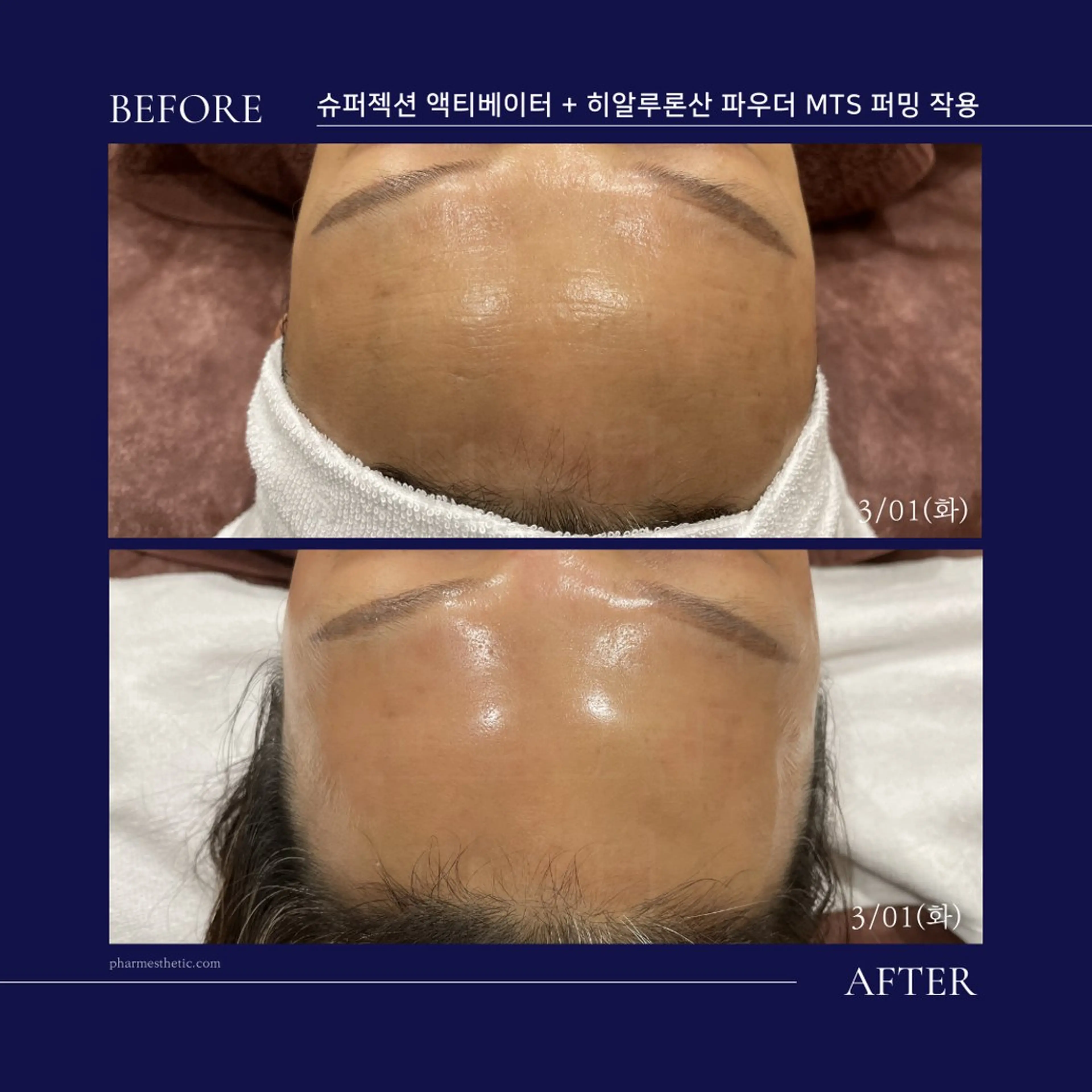 美人スイッチdiet スーパージェクションのその他イメージ