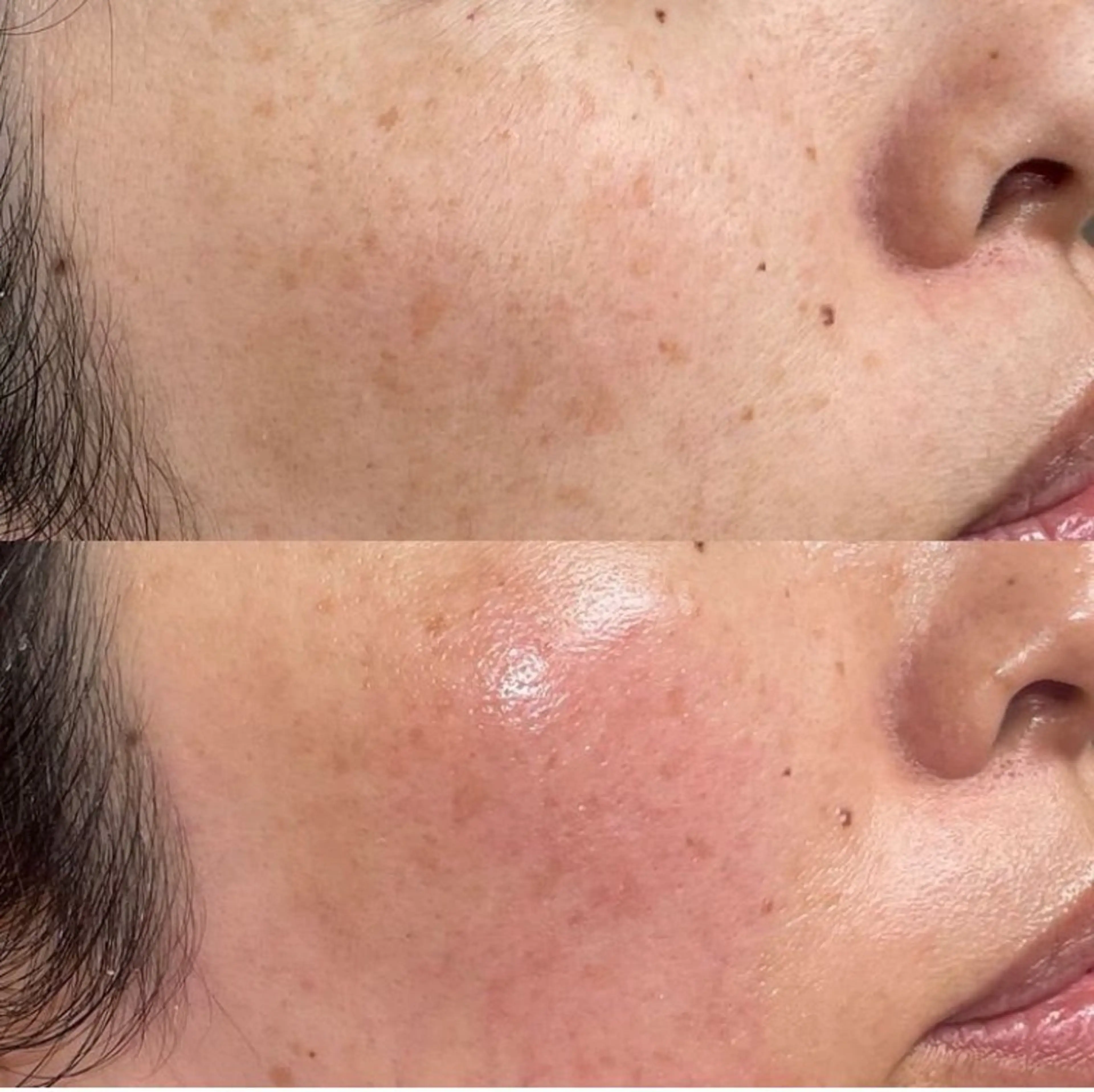 エステ Lumiere despoir所属・Lumiere despoirのエステ・リラクイメージ