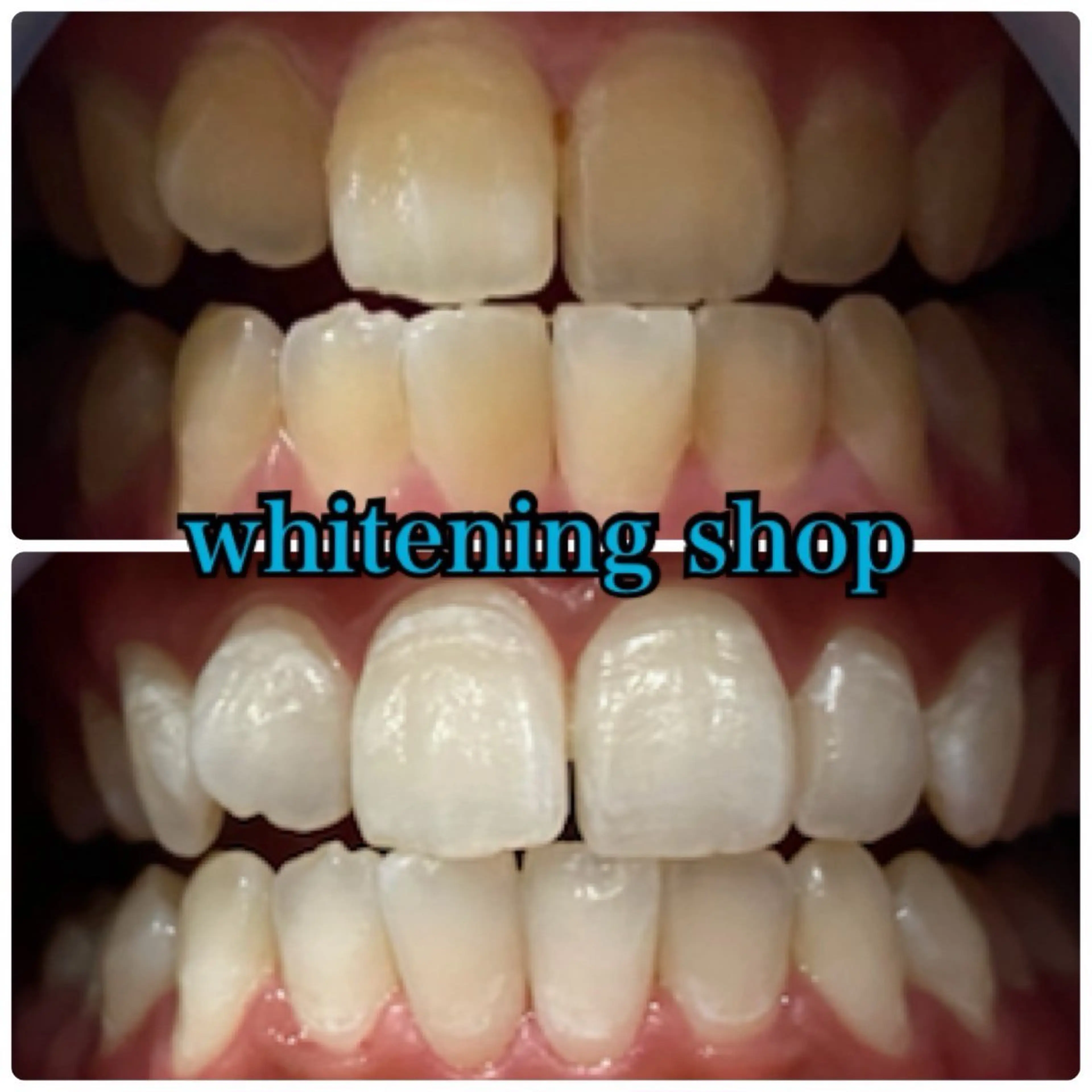 メンズ エステ リラク ホワイトニング ショップ川越店のエステ・リラクイメージ