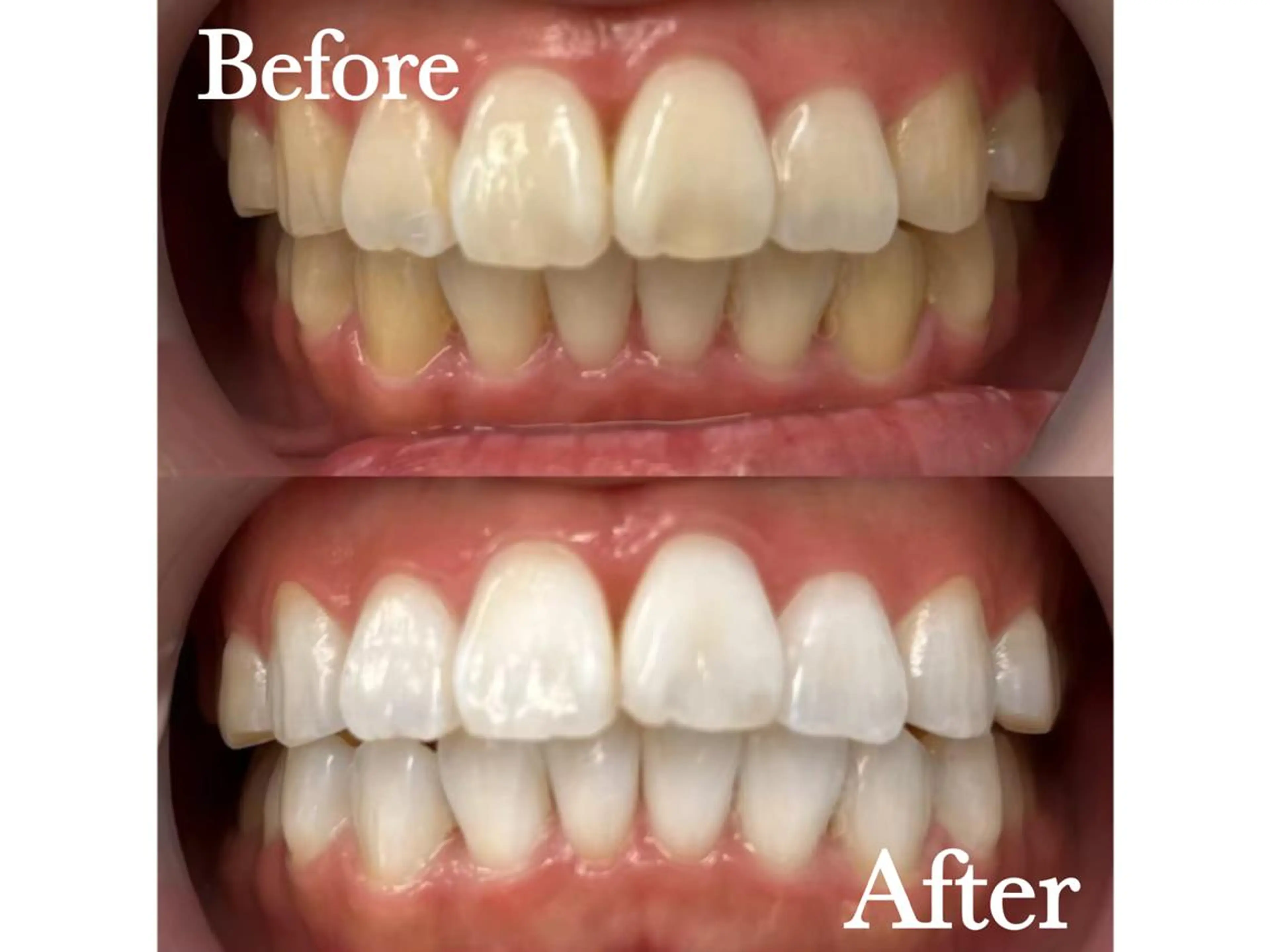 エステ リラク LBSホワイトニング 🌐渋谷店 公式のエステ・リラクイメージ