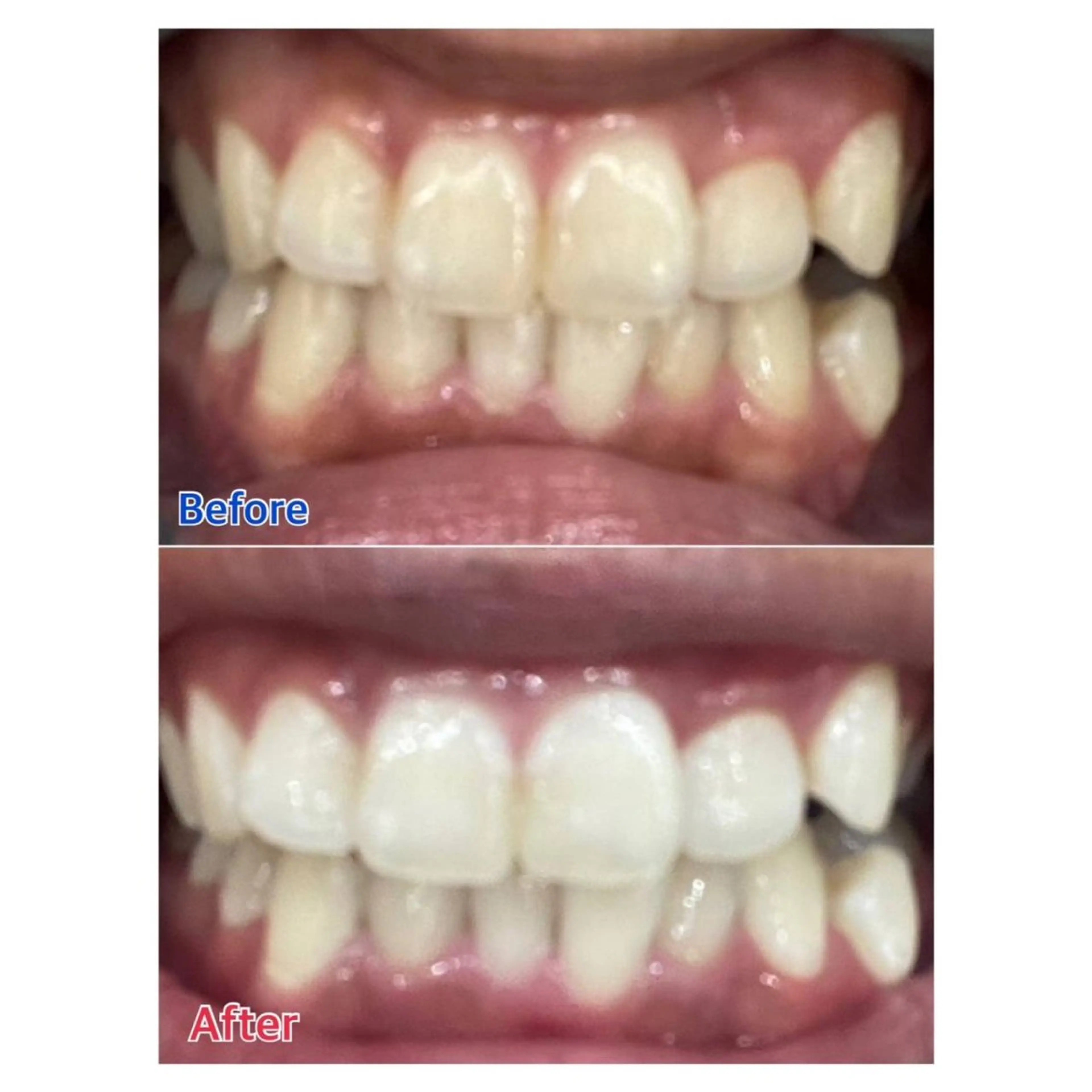 Melty 輝のその他イメージ