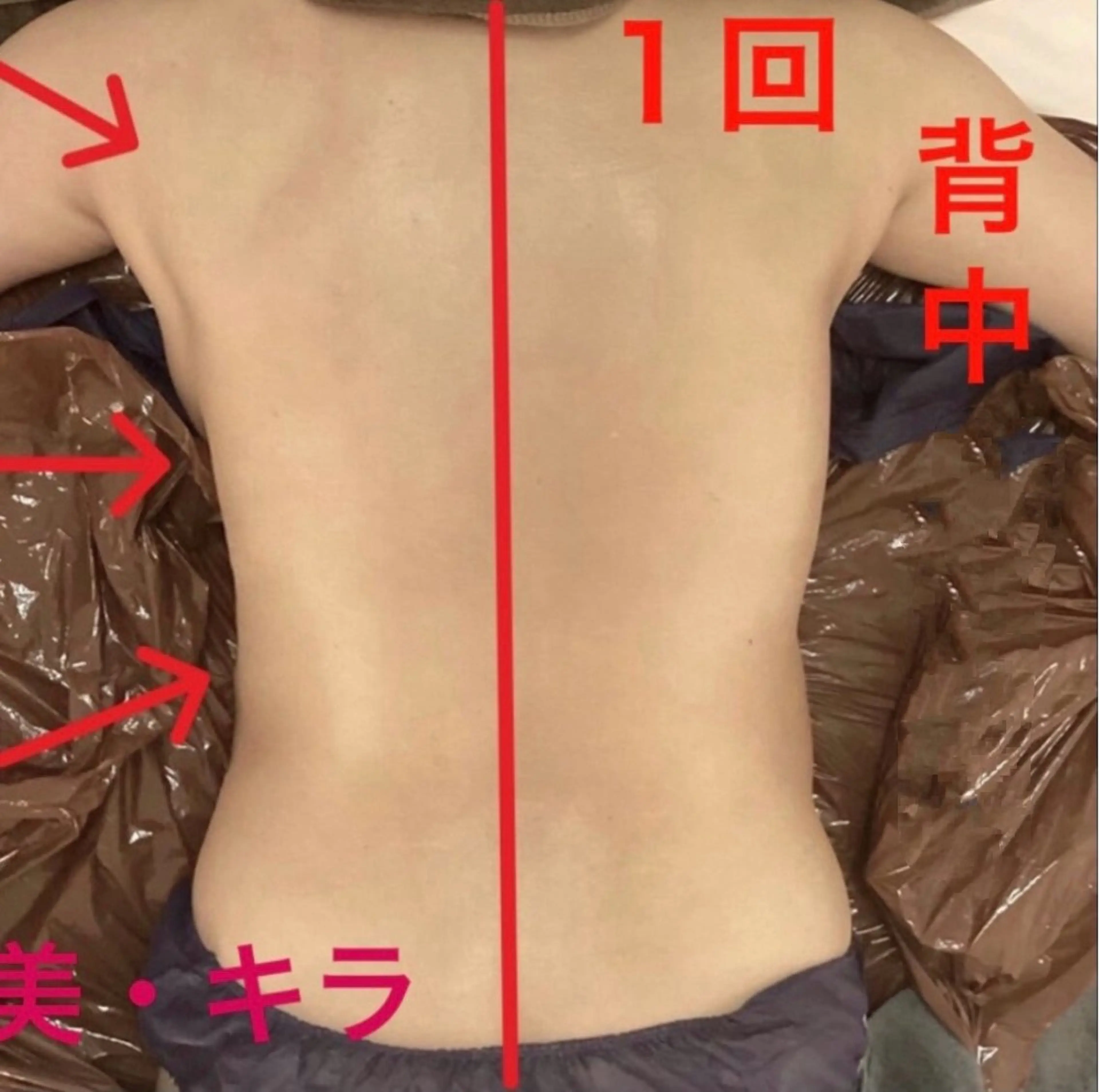 エステ リラク 美・キラ ハイフ痩身&美肌のエステ・リラクイメージ