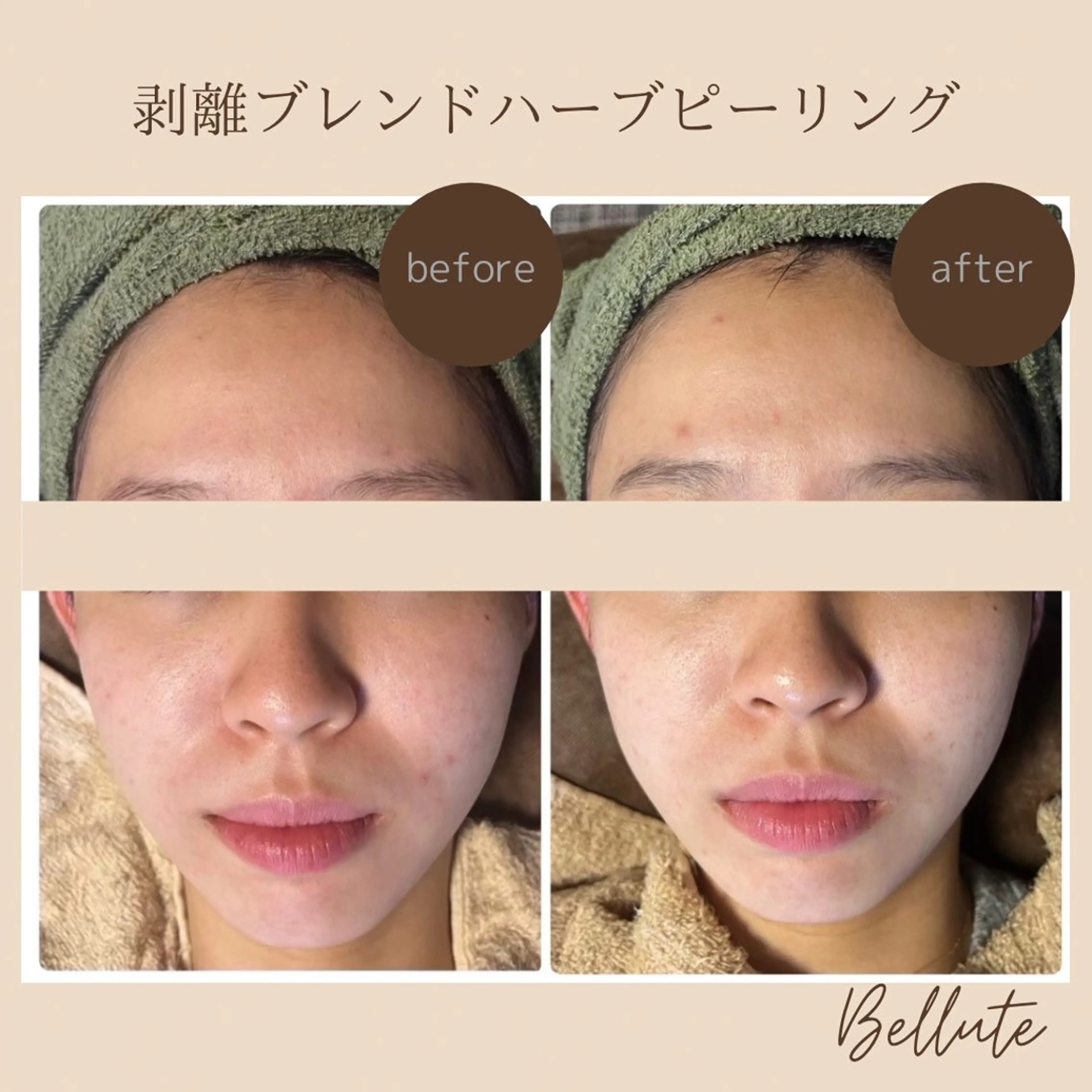 エステ リラク ピーリング専門店 Belluteのエステ・リラクイメージ