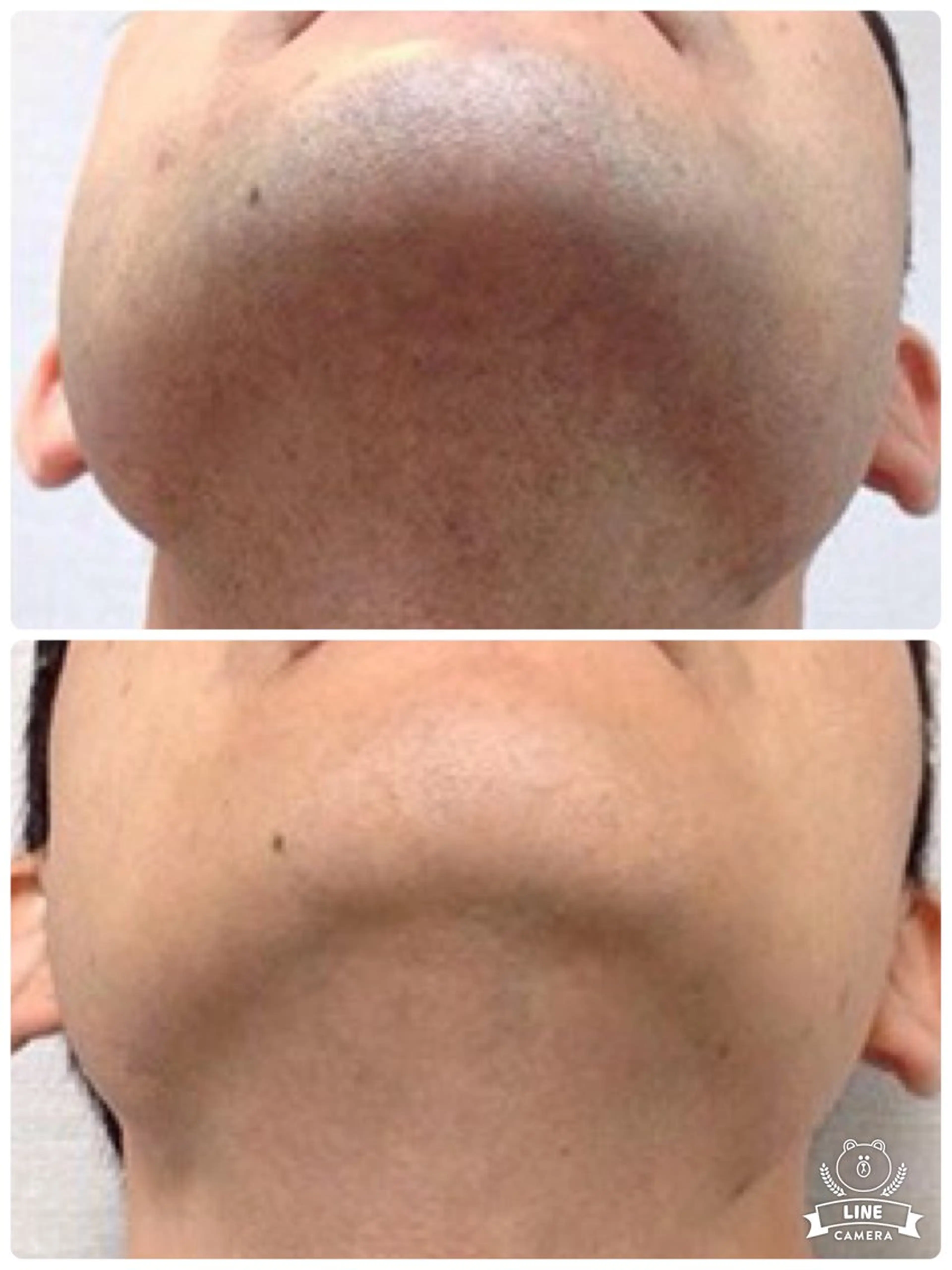 メンズ キッズ 脱毛・美肌サロン Epi Houseのその他イメージ