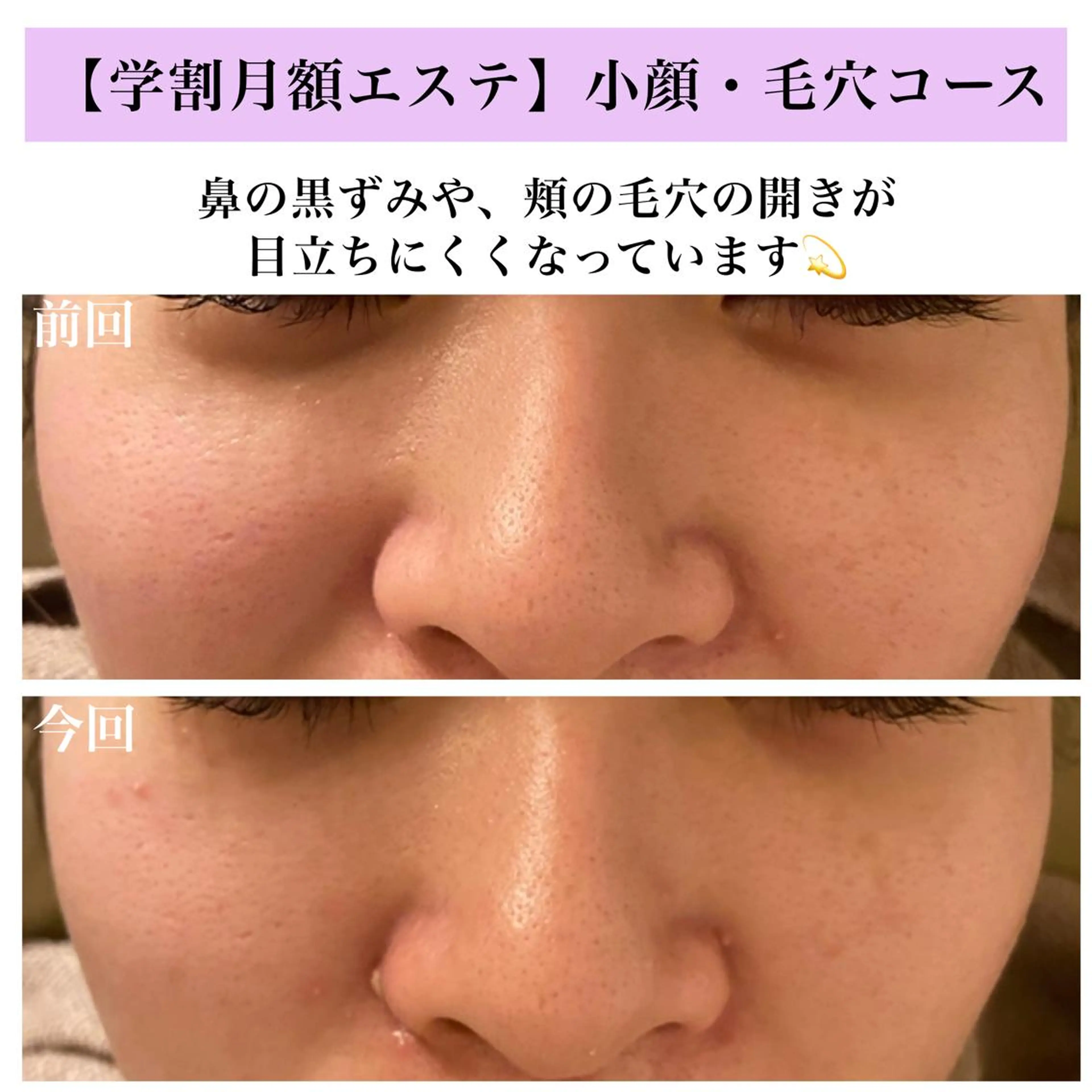 Bellesthe (ベルエステ)のエステ・リラクイメージ