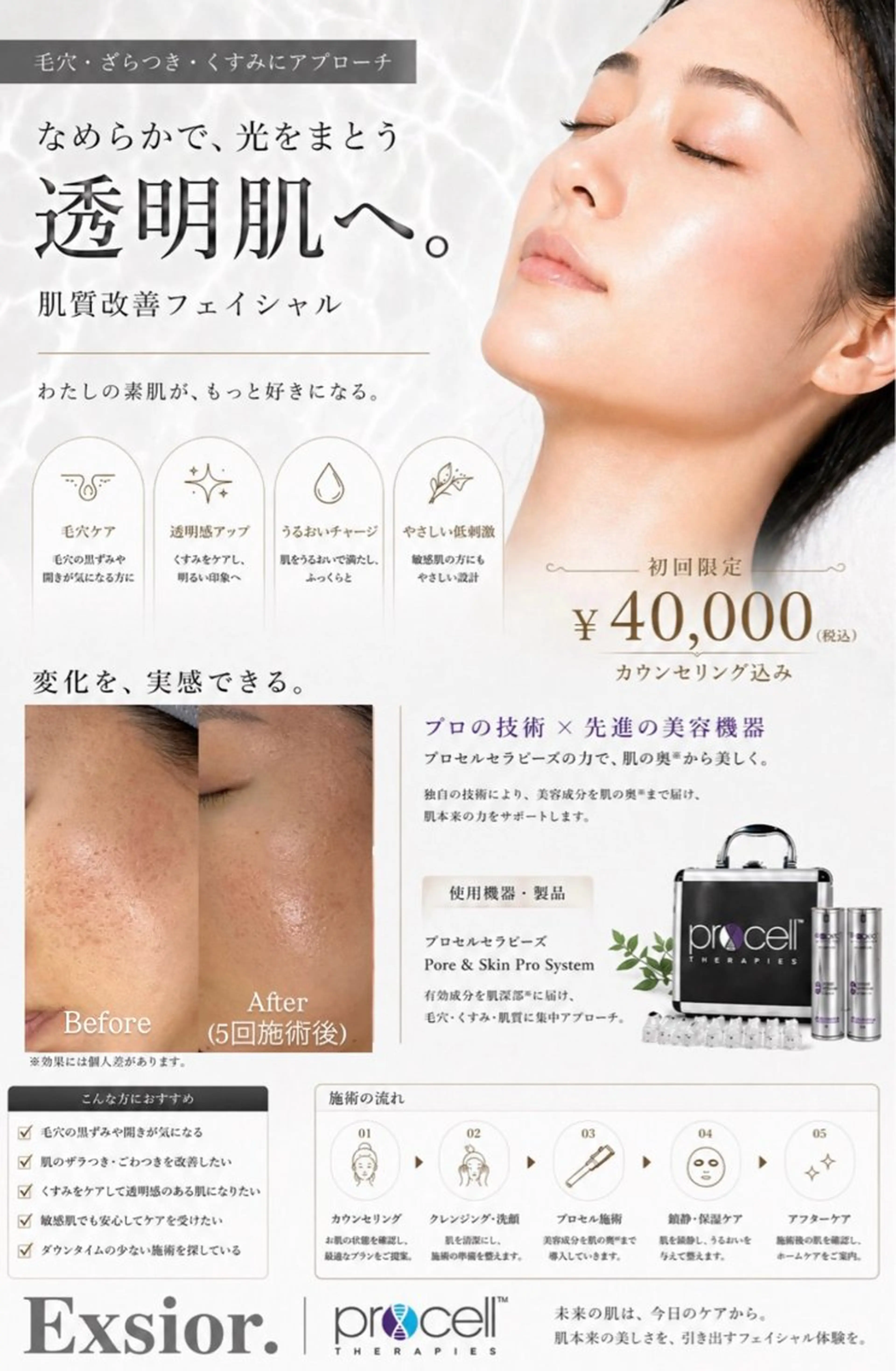 エステ 脱毛サロン Exsior.博多店の眉毛・アイブロウイメージ