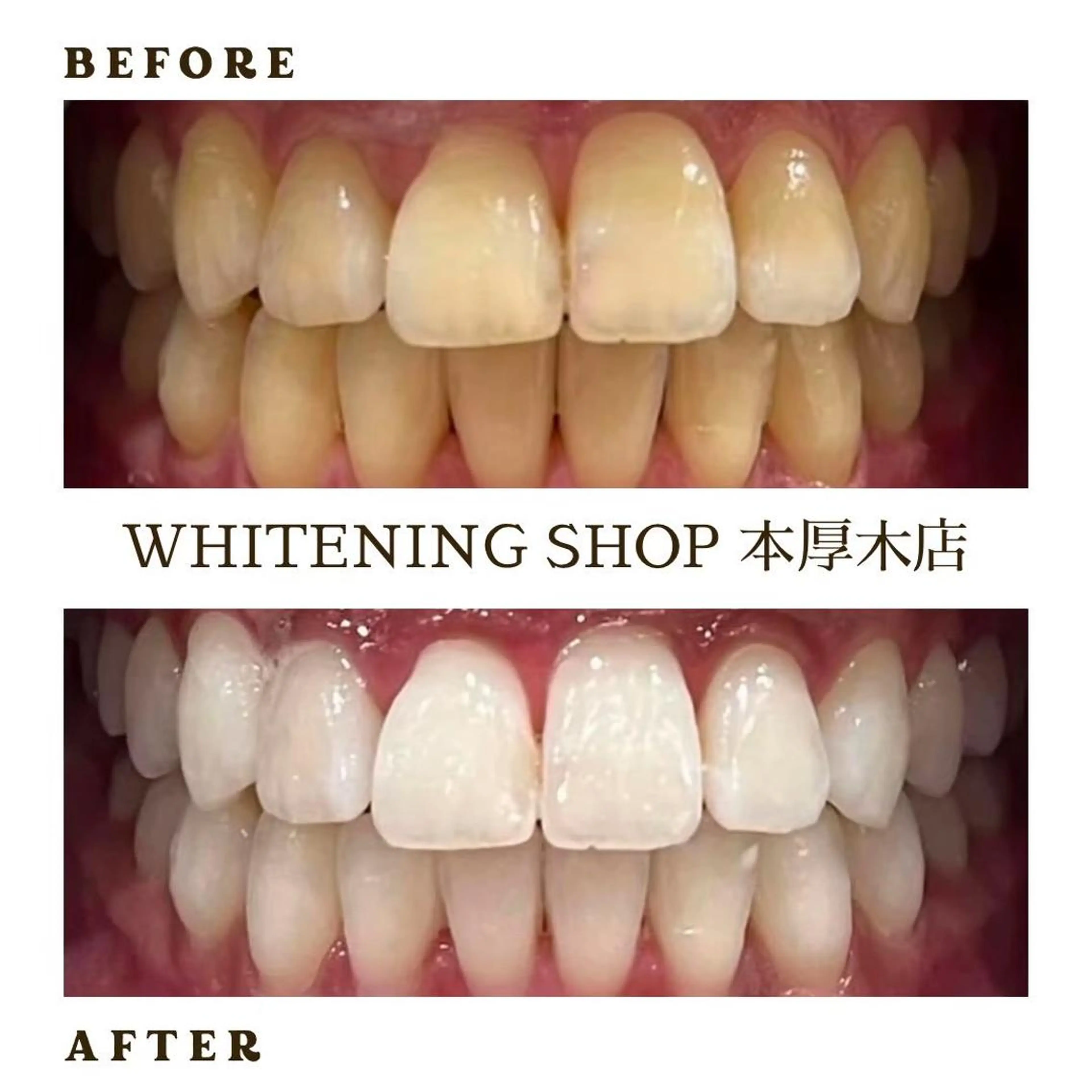 メンズ その他 ホワイトニング ショップ本厚木のその他イメージ