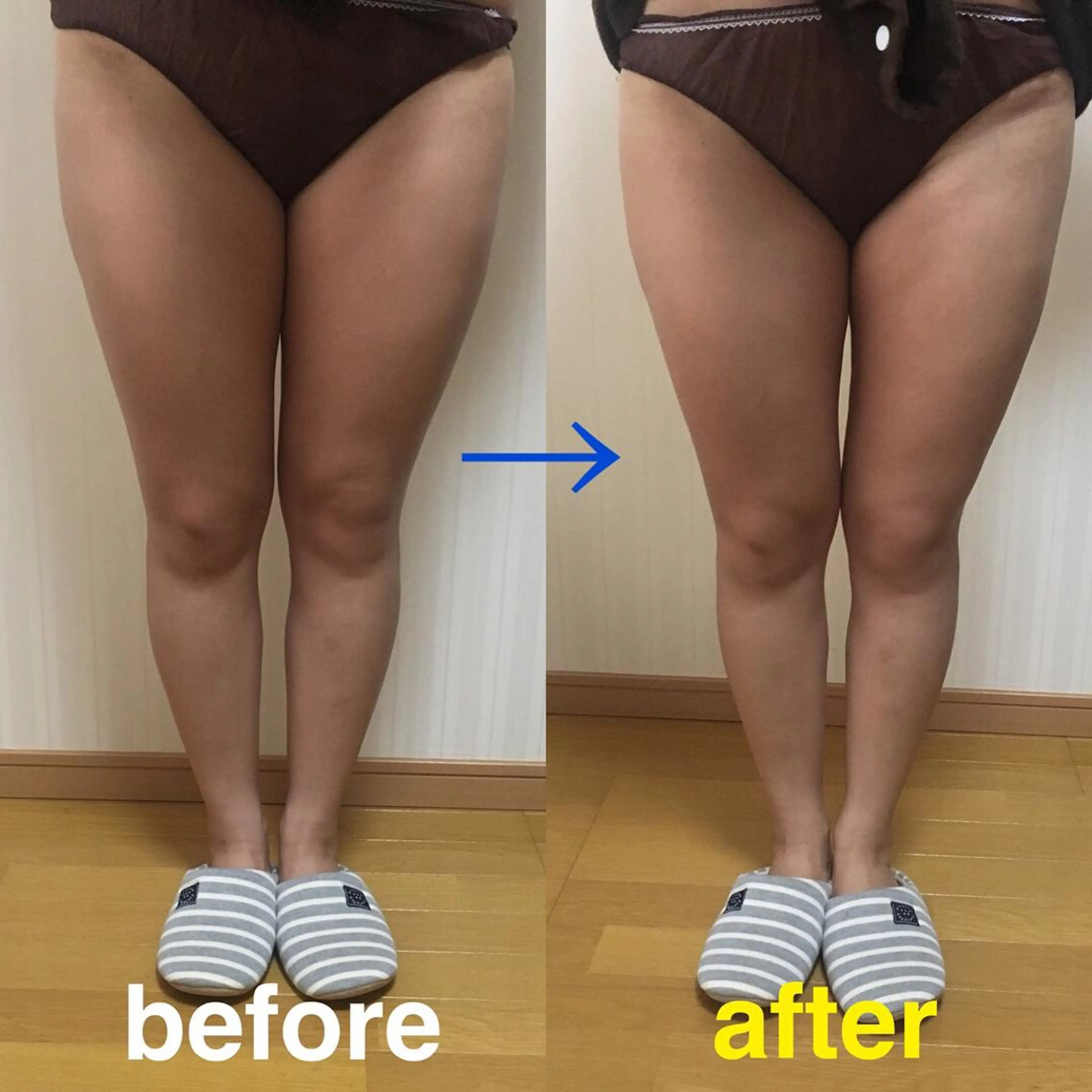 🌸ボディ人気No.2🌸ご新規様minimo限定価格<背面極上リンパマッサージ>フットバス付きの写真