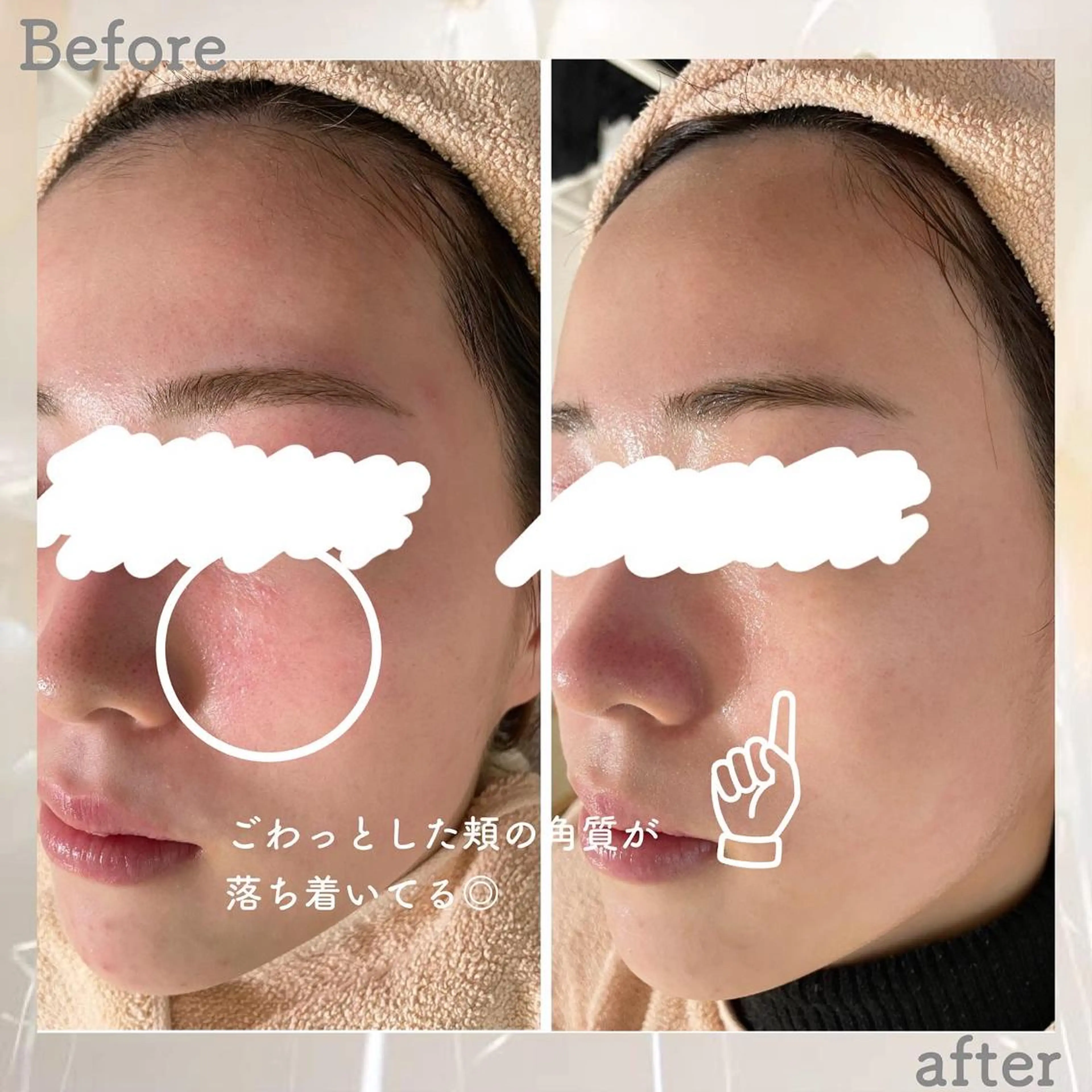 エステ ニキビ&跡改善サロン オーナー光木のエステ・リラクイメージ