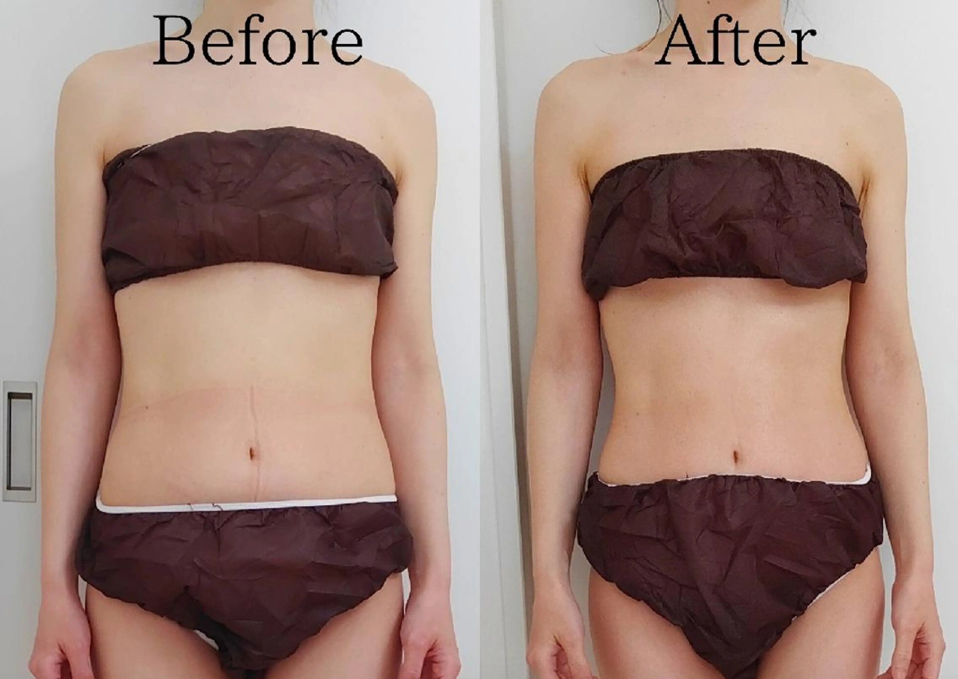 ユニセックスエステサロンUniclear所属・佐賀痩身エステ/小顔 @uni.clearのエステ・リラクイメージ