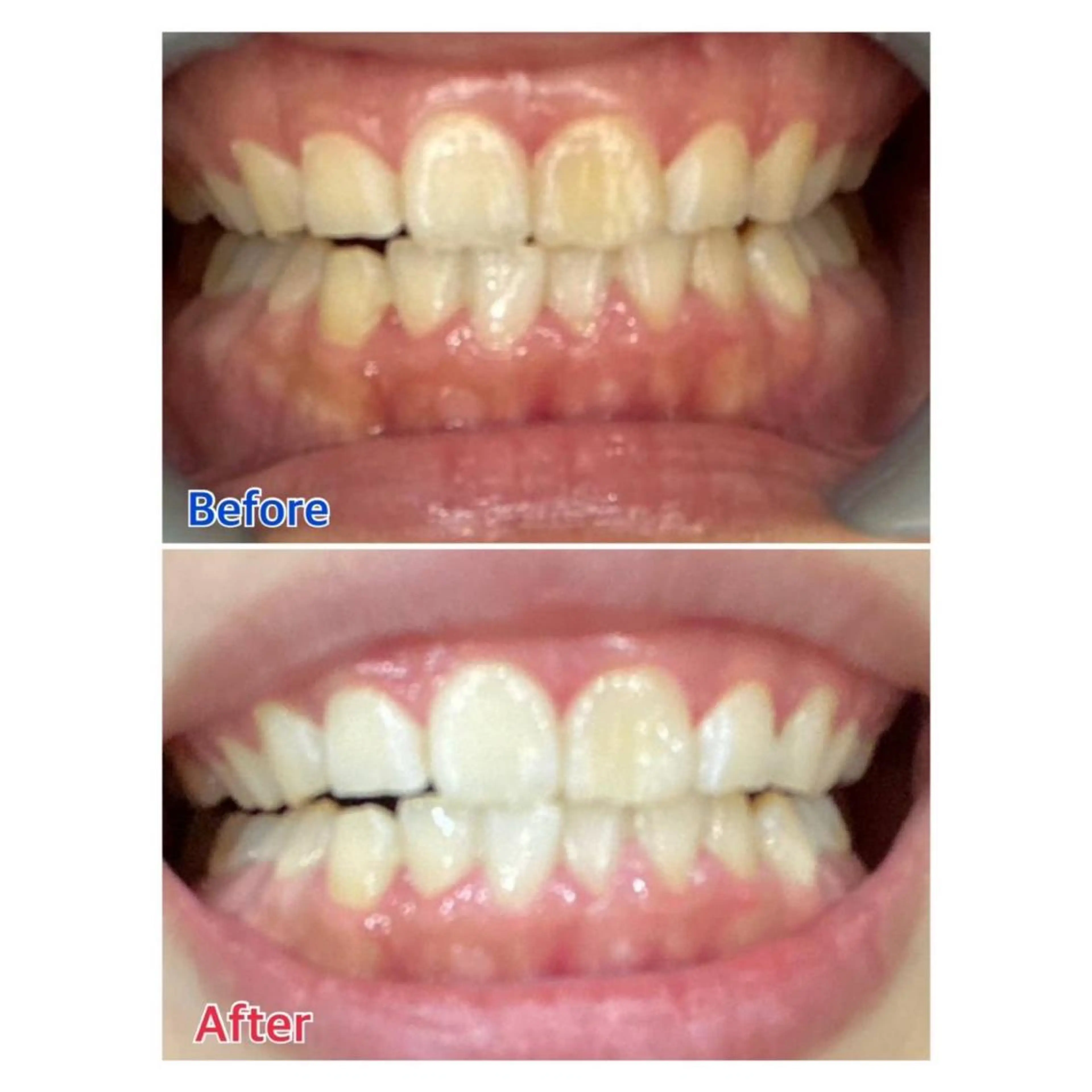 MBEAUTYSALON 千葉店・京成大久保所属・Melty 輝のその他イメージ