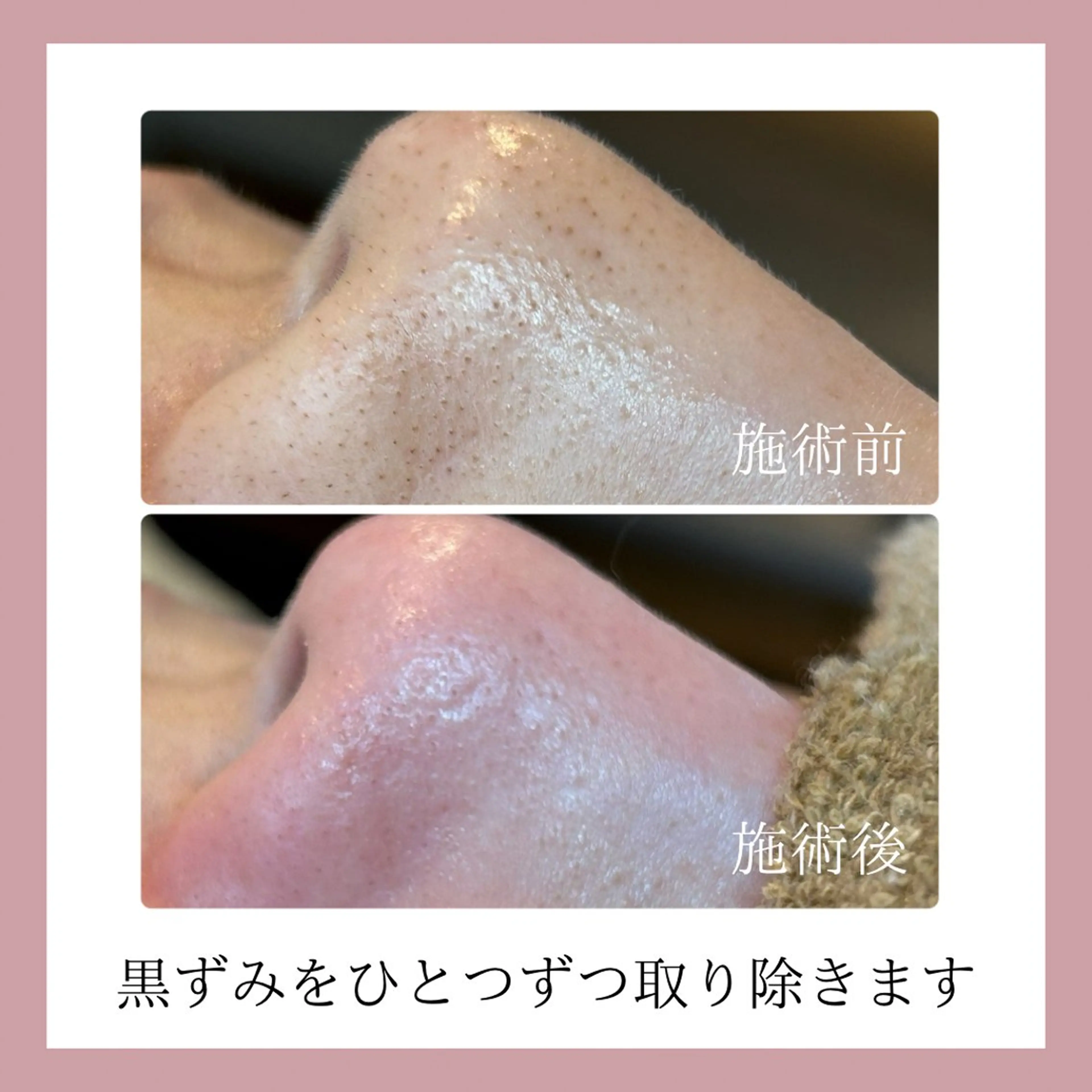 美肌脱毛&毛穴専門 Nico🐰ྀི♡のエステ・リラクイメージ