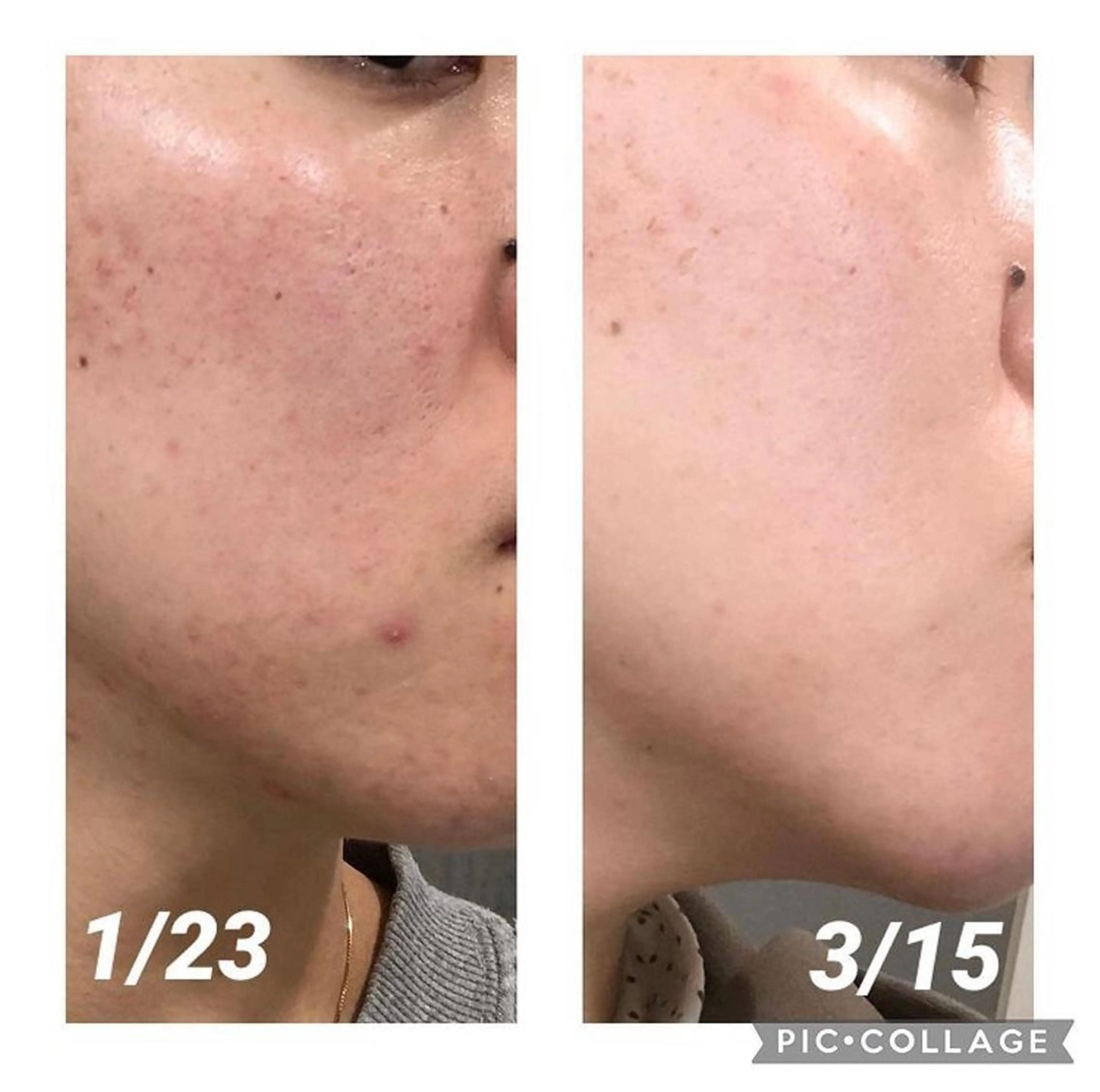 tominaga ryokoのヘアスタイル