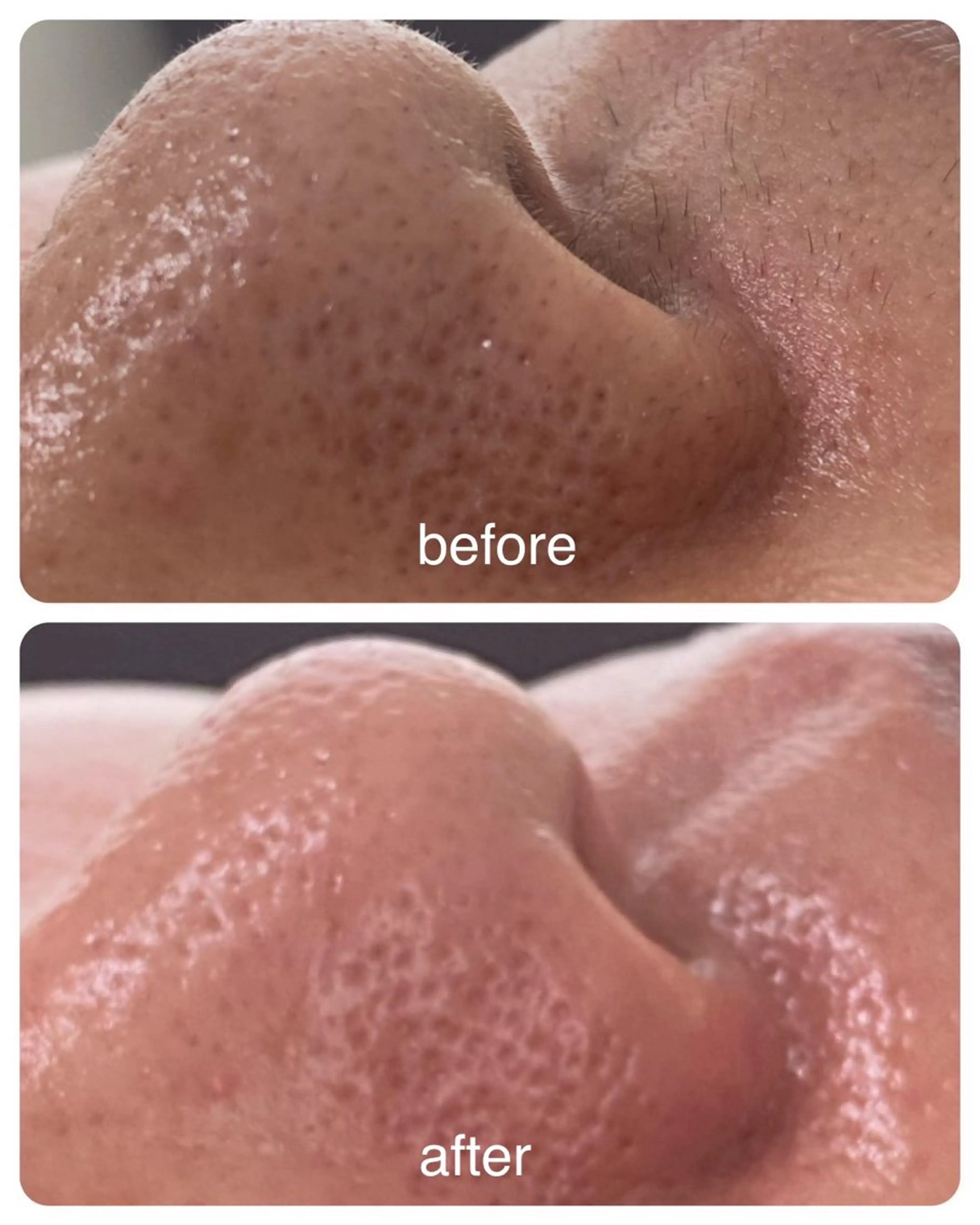 【mai*】マツヤニ ボディ/ベッドスパのエステ・リラクイメージ