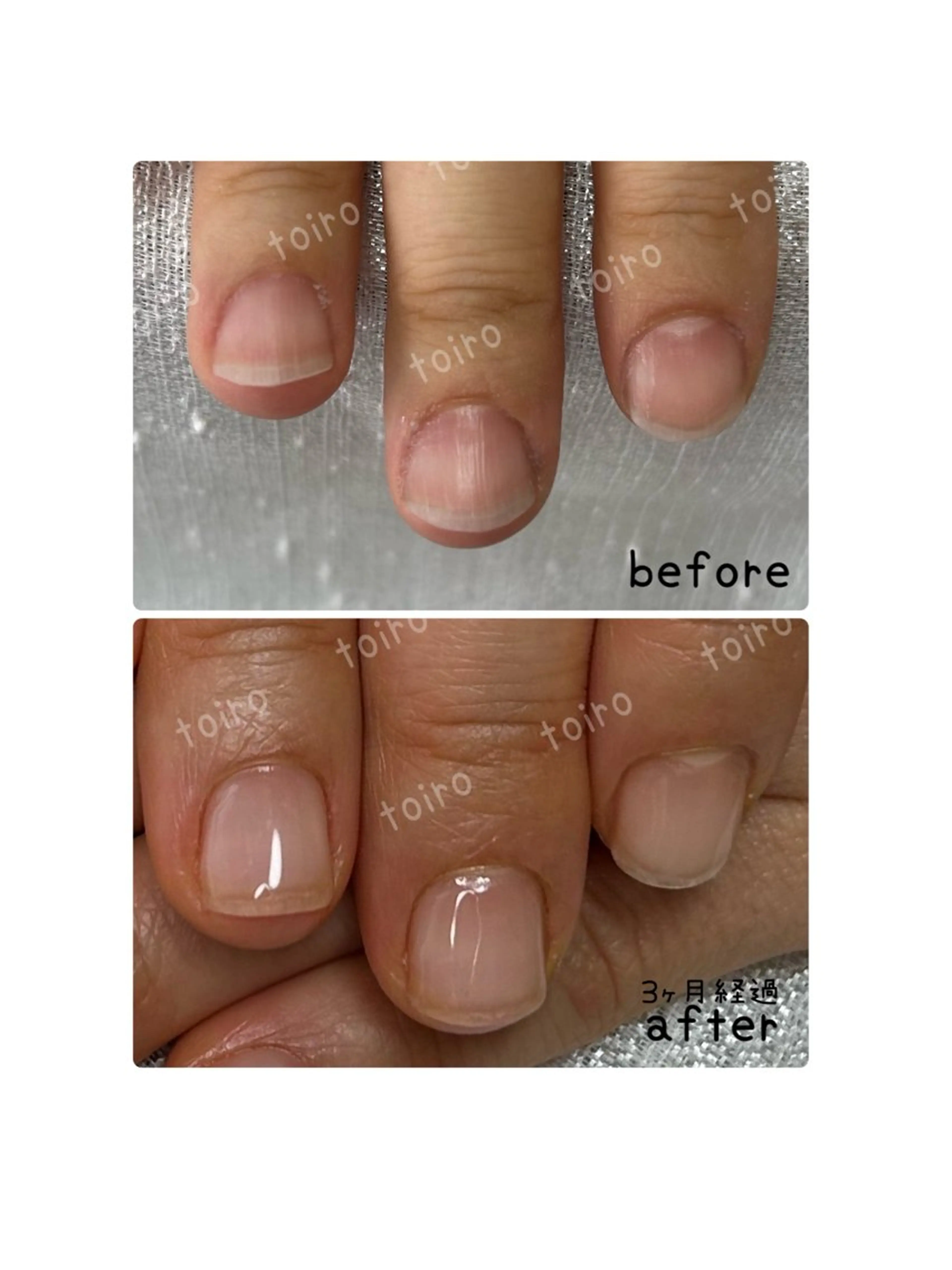 ネイル育成ケア　クリアジェル仕上げ💅の写真