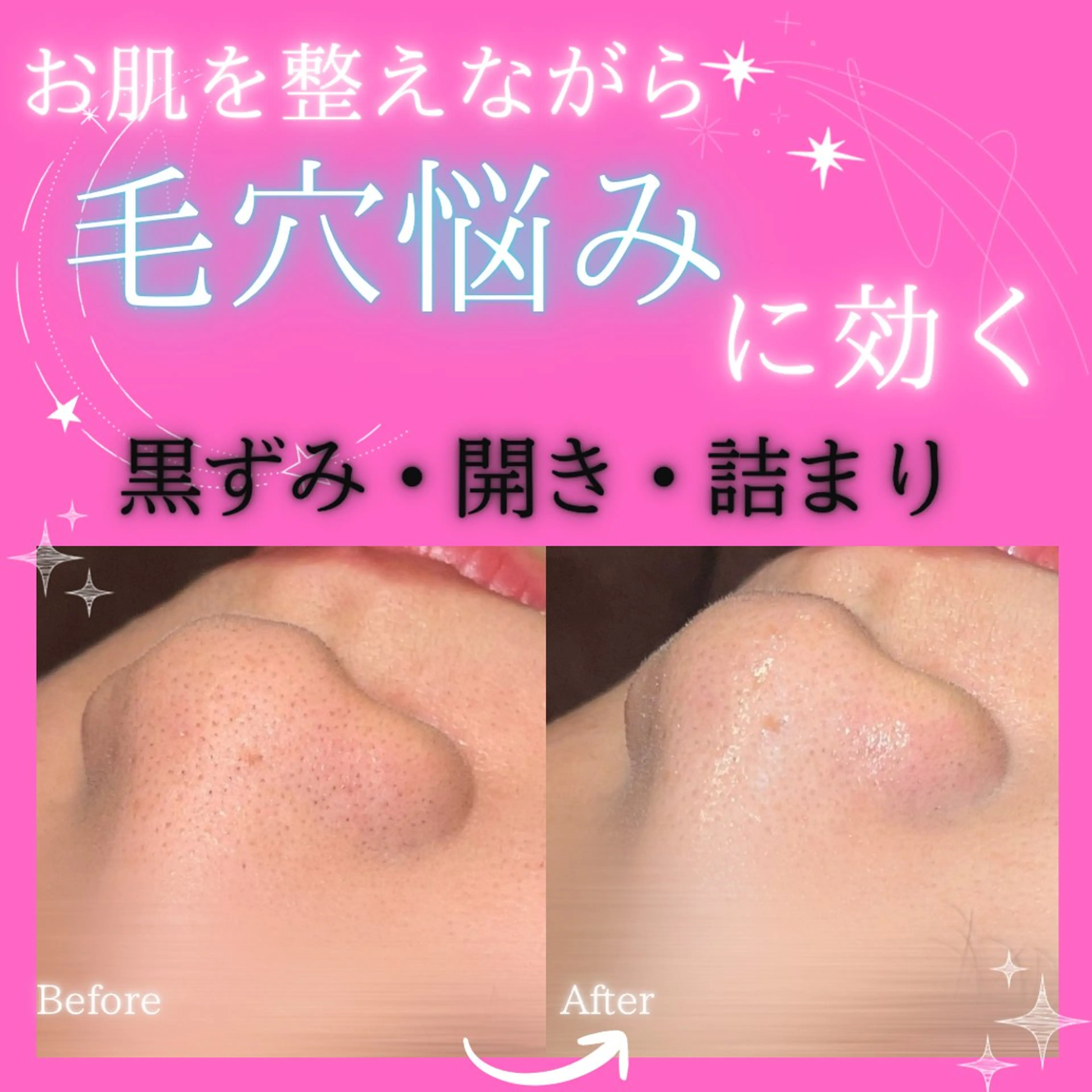 エステ リラク 痩身&美肌サロン 堀米✨のその他イメージ